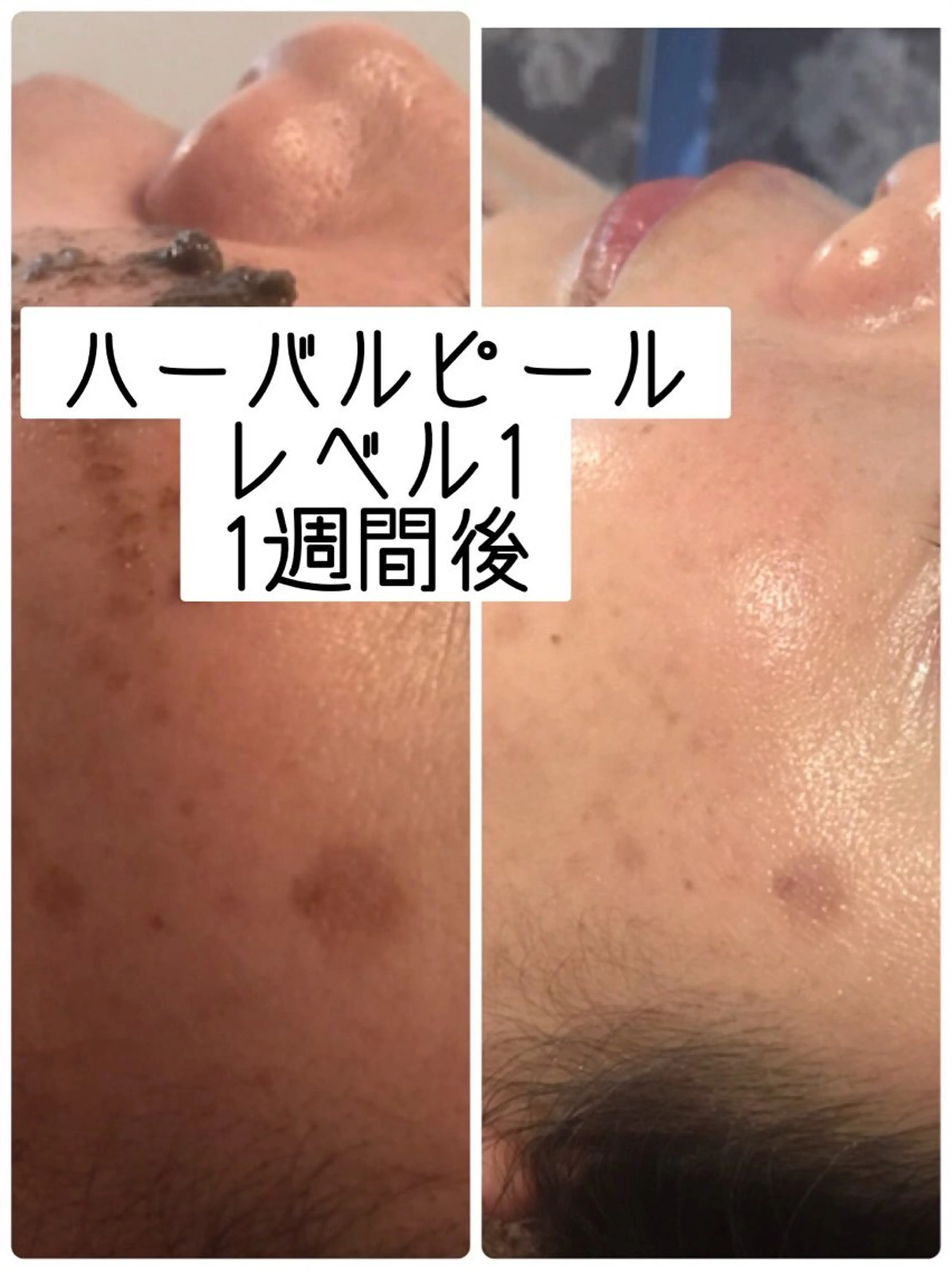 エステ エステティック sala藤沢のエステ・リラクイメージ