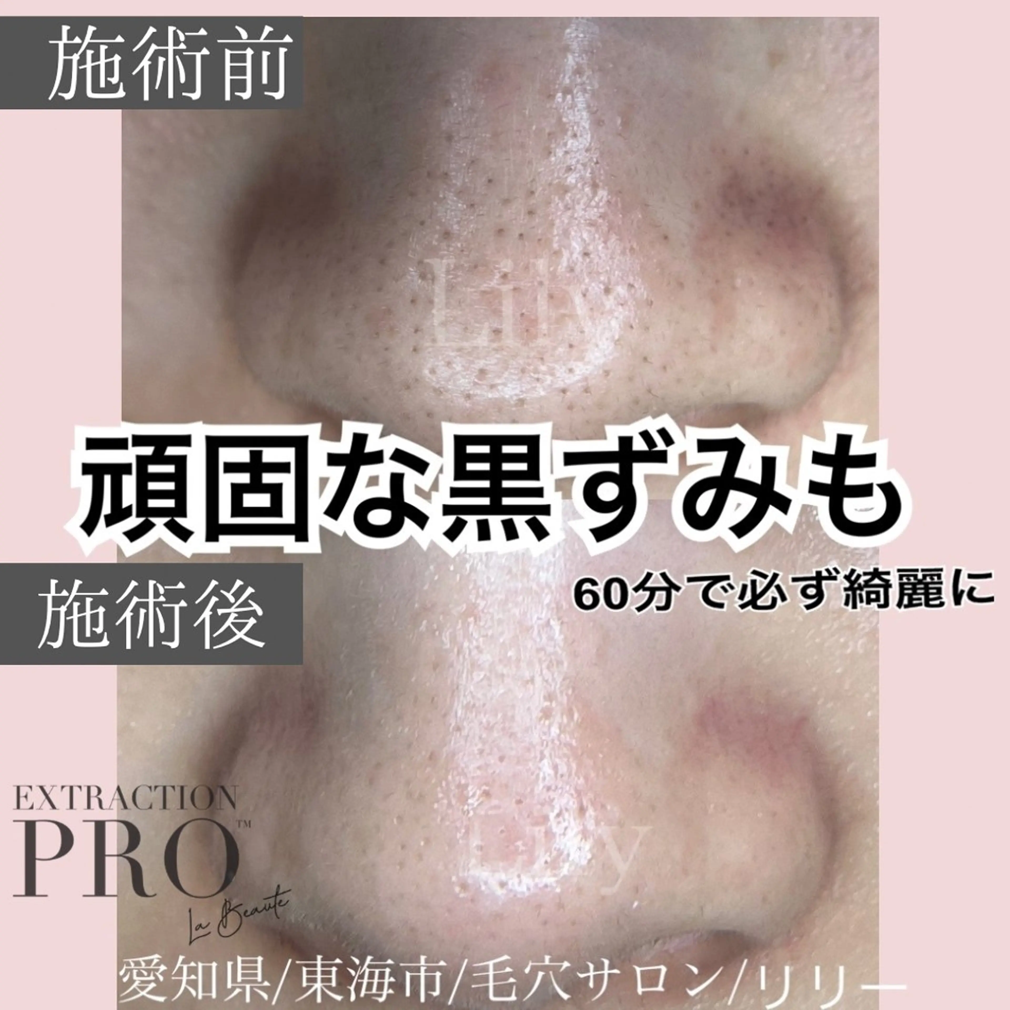 トータルビューティー サロンLilyのエステ・リラクイメージ