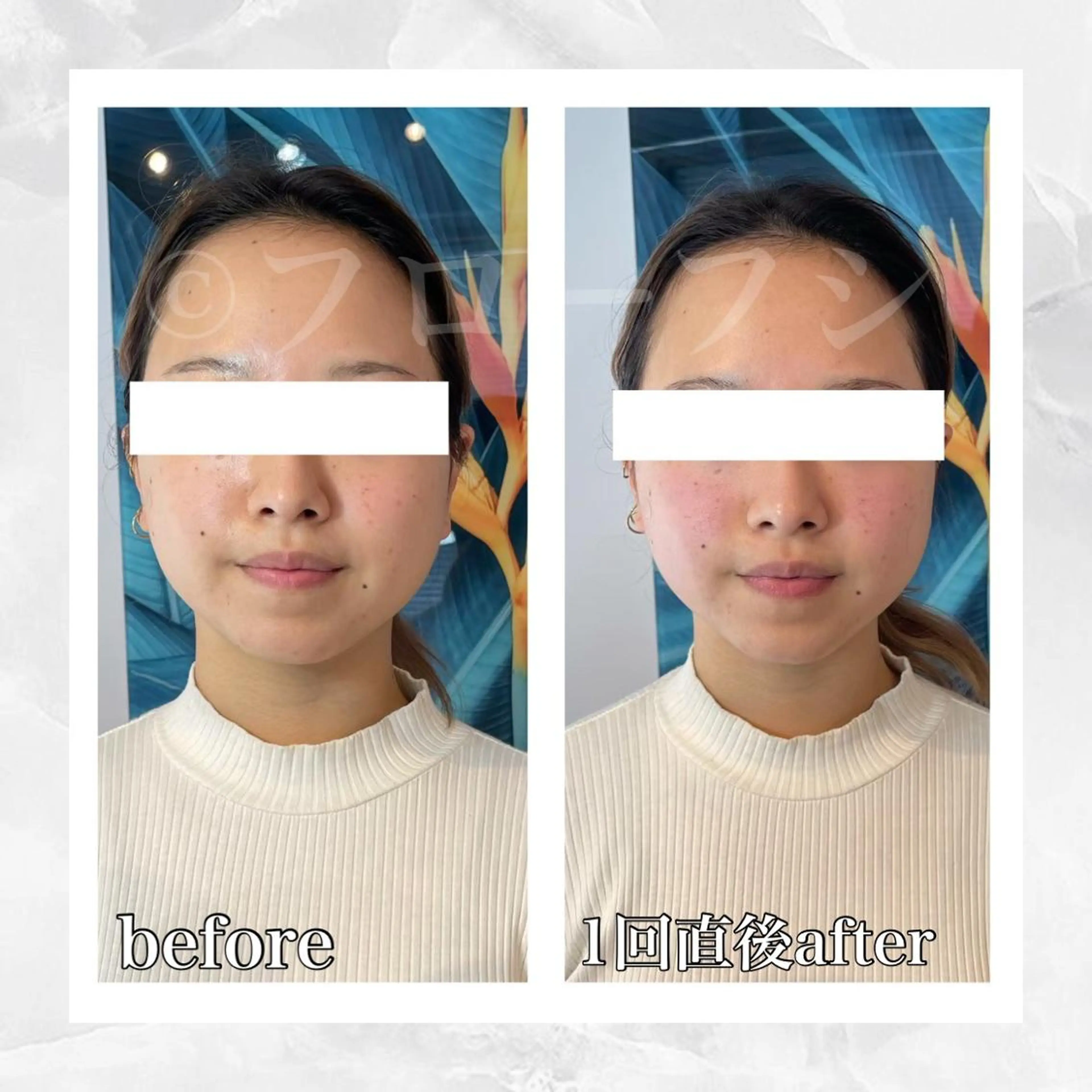 エステ リラク 部分痩せ♥️小顔専門 MIKUのエステ・リラクイメージ