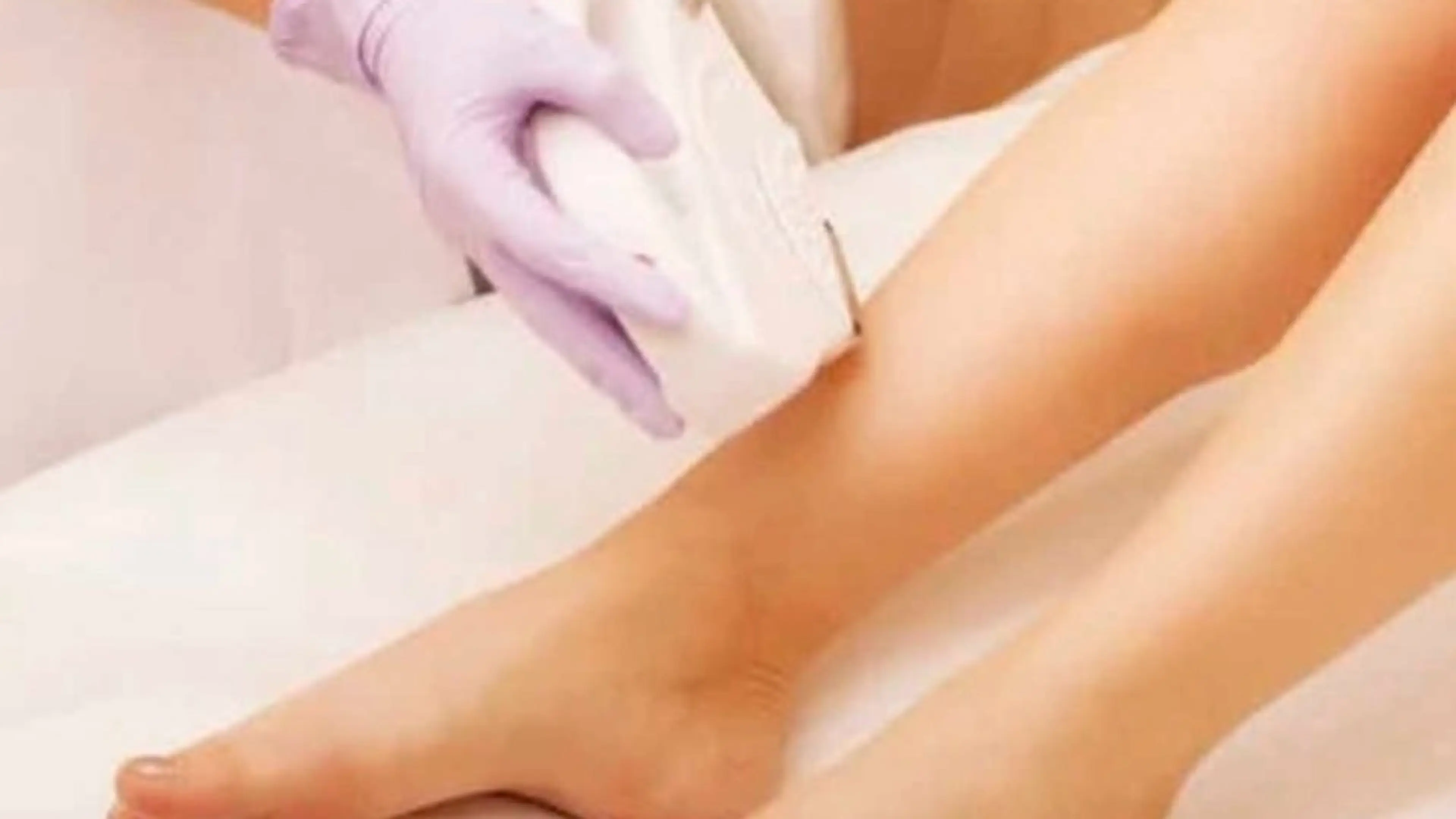 キッズ部分脱毛　１箇所の写真