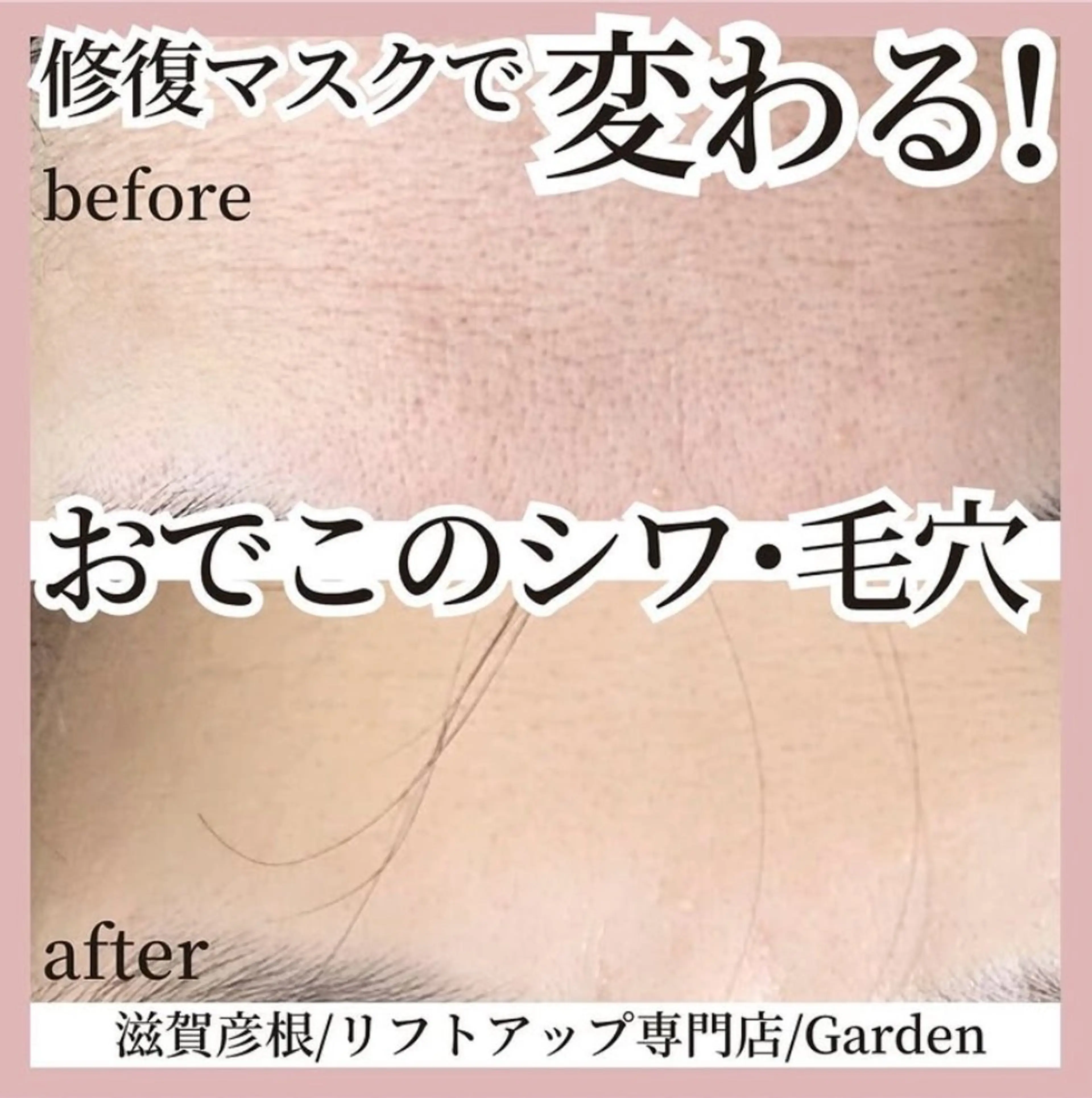 リフトアップ専門店 Gardenこやまのエステ・リラクイメージ