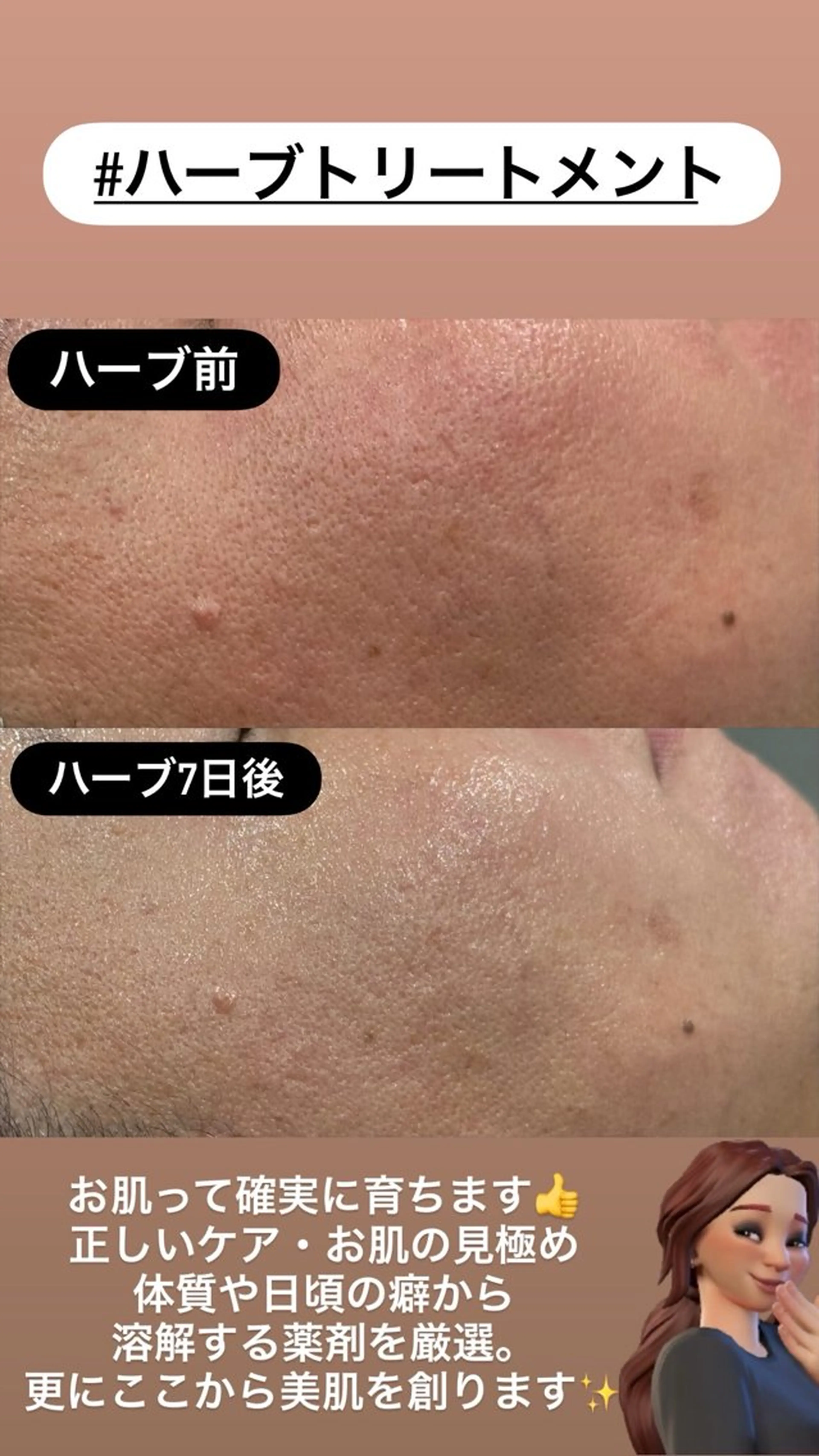 エステ LiZA エステティックサロンのエステ・リラクイメージ