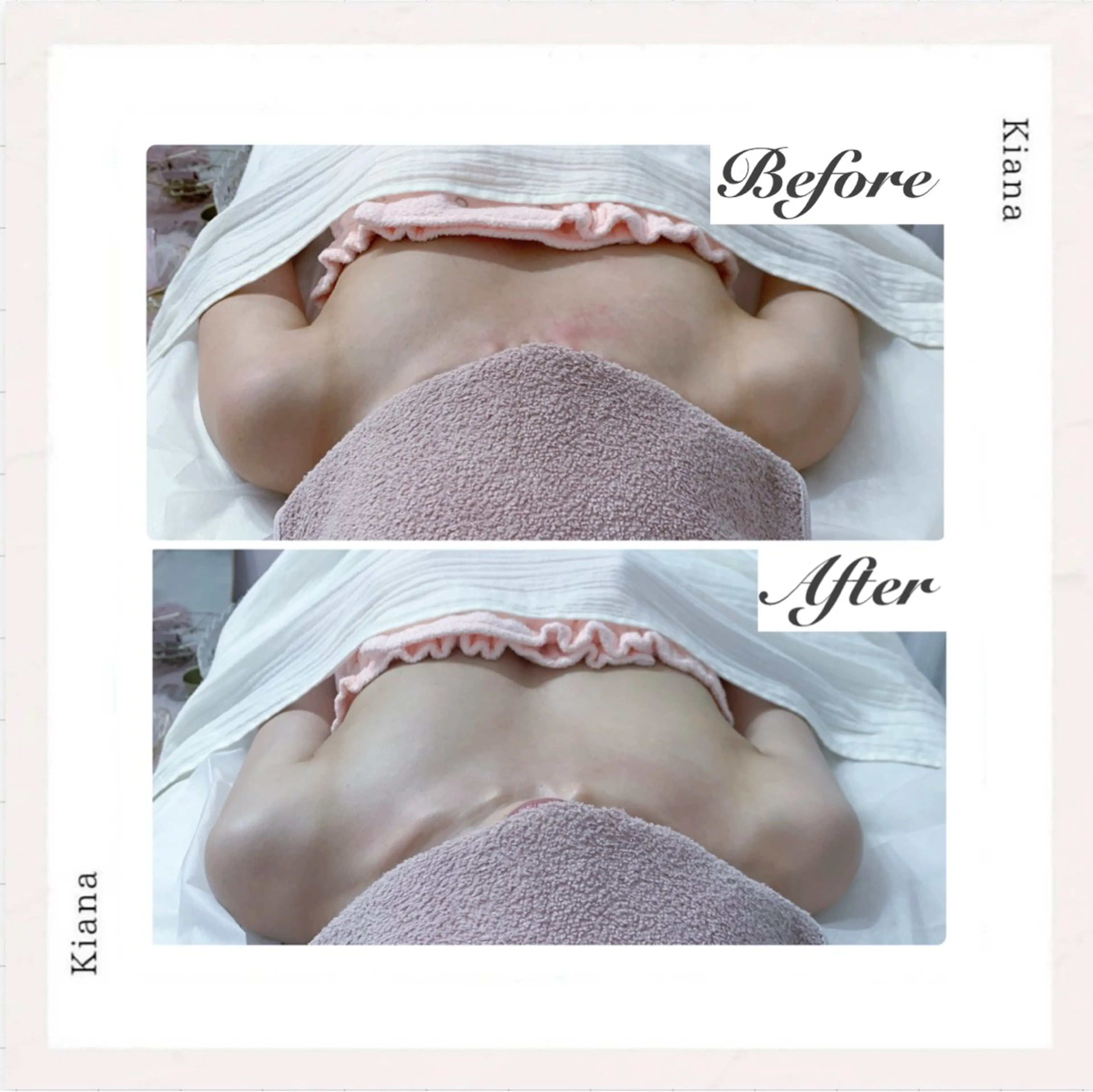 エステ リラク バスト専門Kiana 風のエステ・リラクイメージ