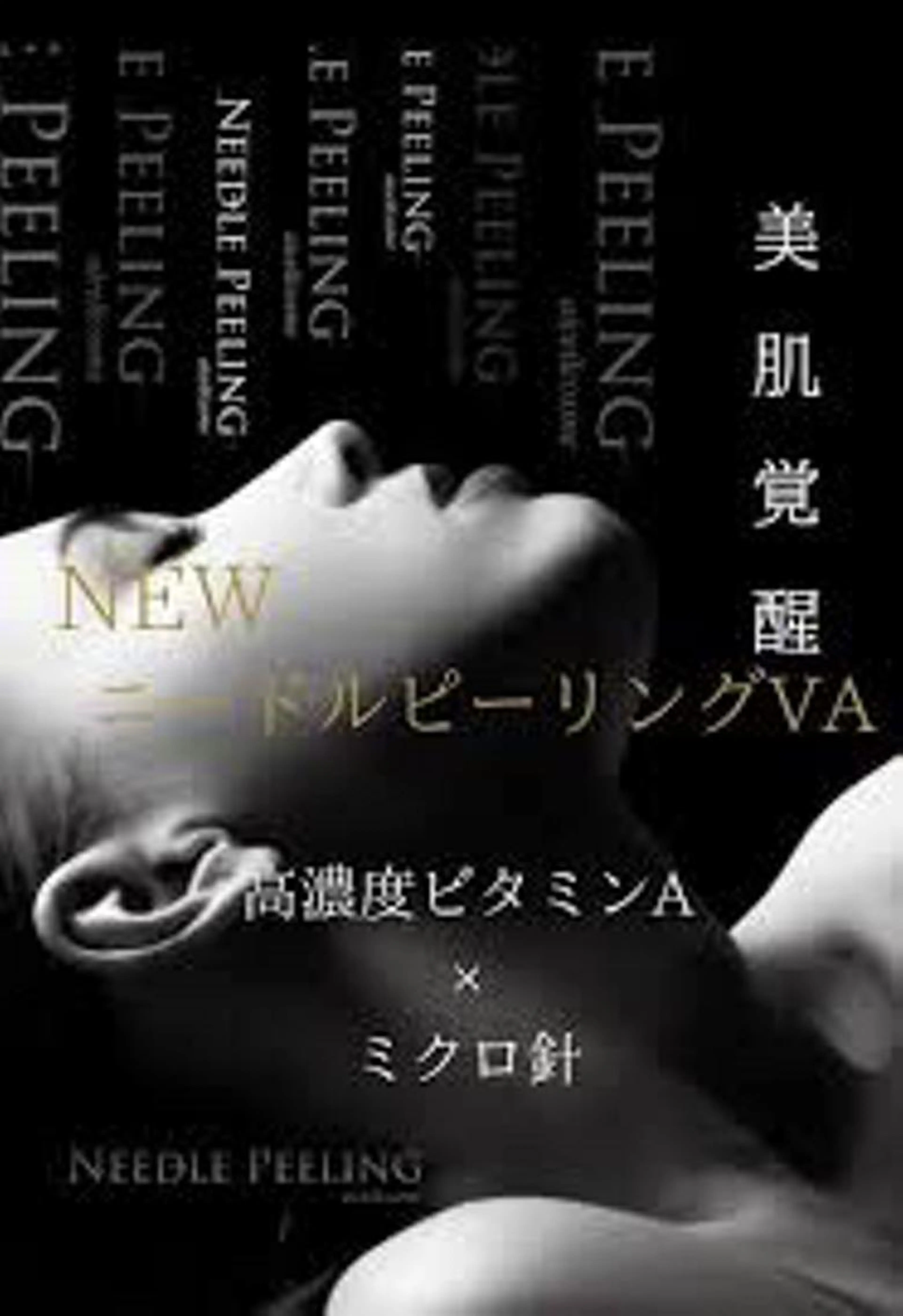 お肌ツルツル✨高濃度ビタミンA導入💍60分通常レチノールマイクロニードルピーリング¥8000→¥6500の写真