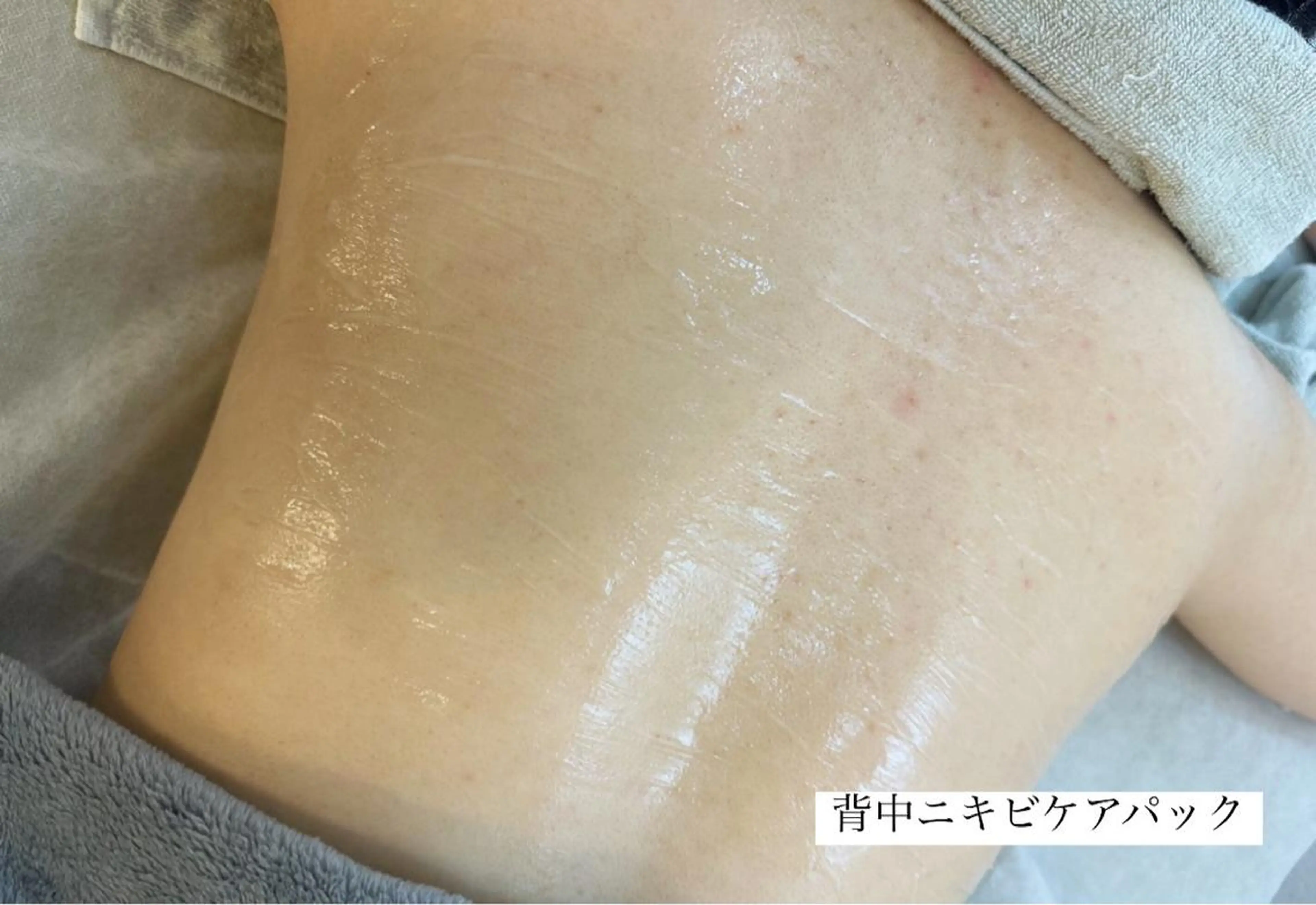 うなじ脱毛/美肌脱毛 LABELのエステ・リラクイメージ