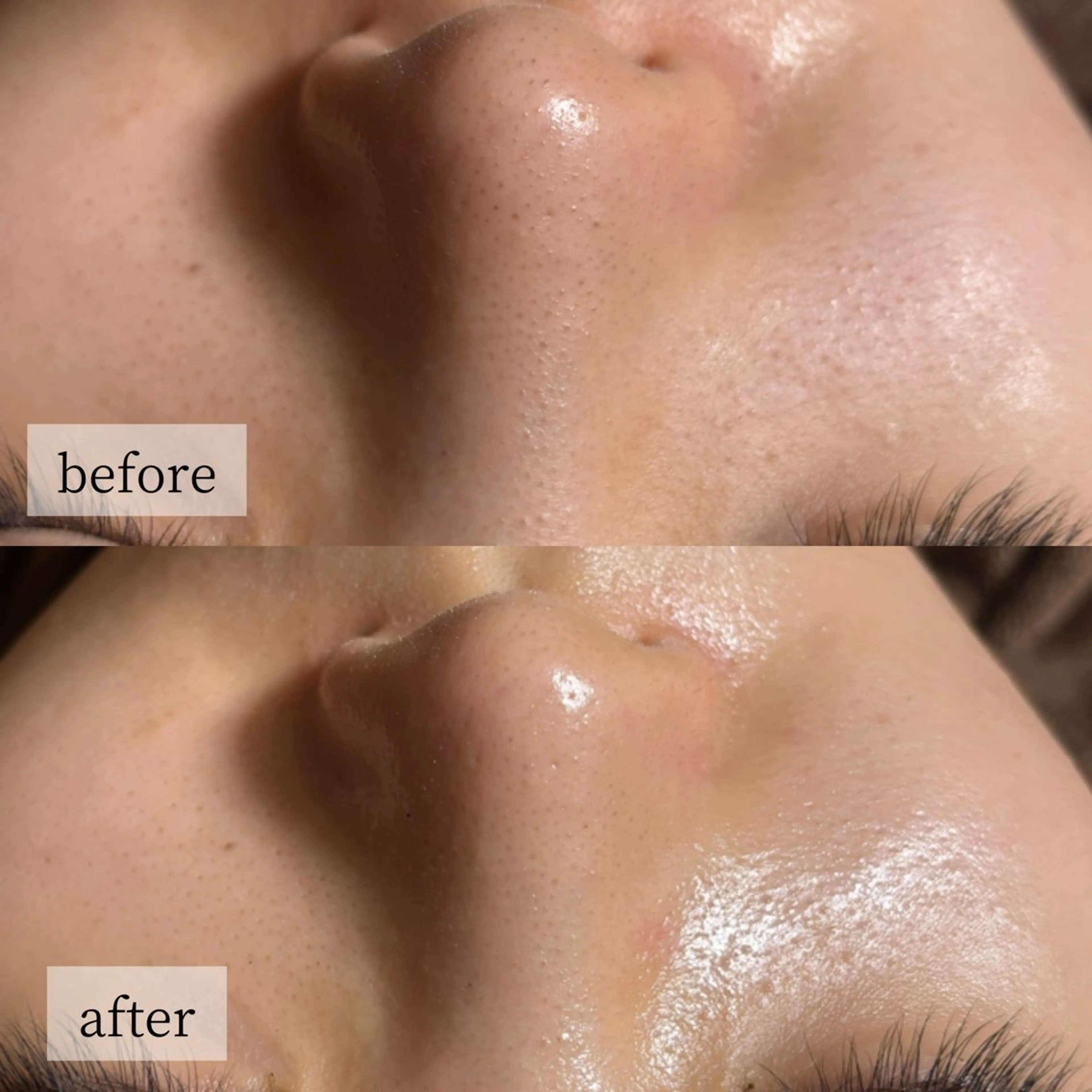 HINANO矢場町店【ヒナノ】所属・脱毛/肌改善🌿 HINANO 村田のエステ・リラクイメージ