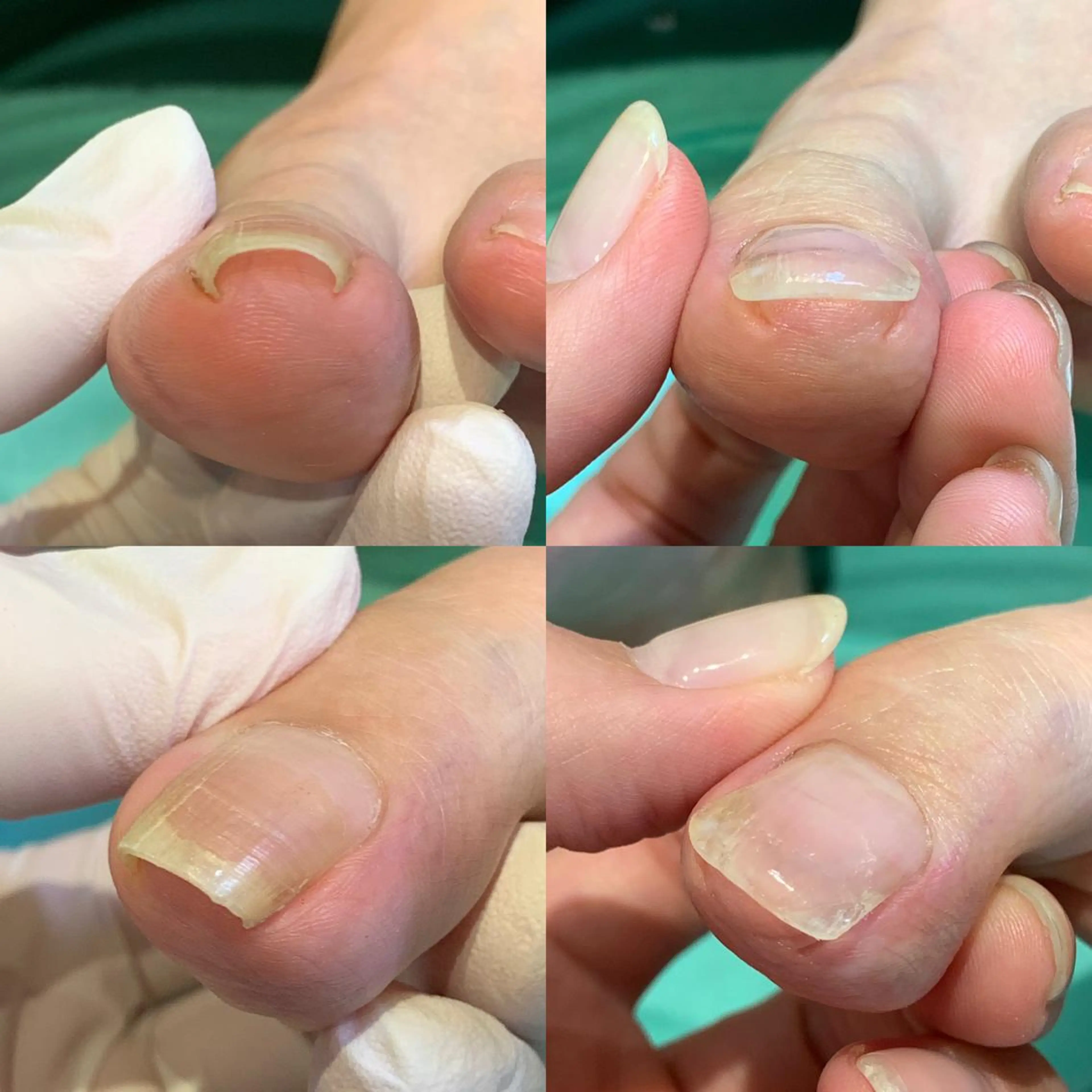 ネイル 東京巻き爪アカデミー所属・東京巻き爪 アカデミーのエステ・リラクイメージ