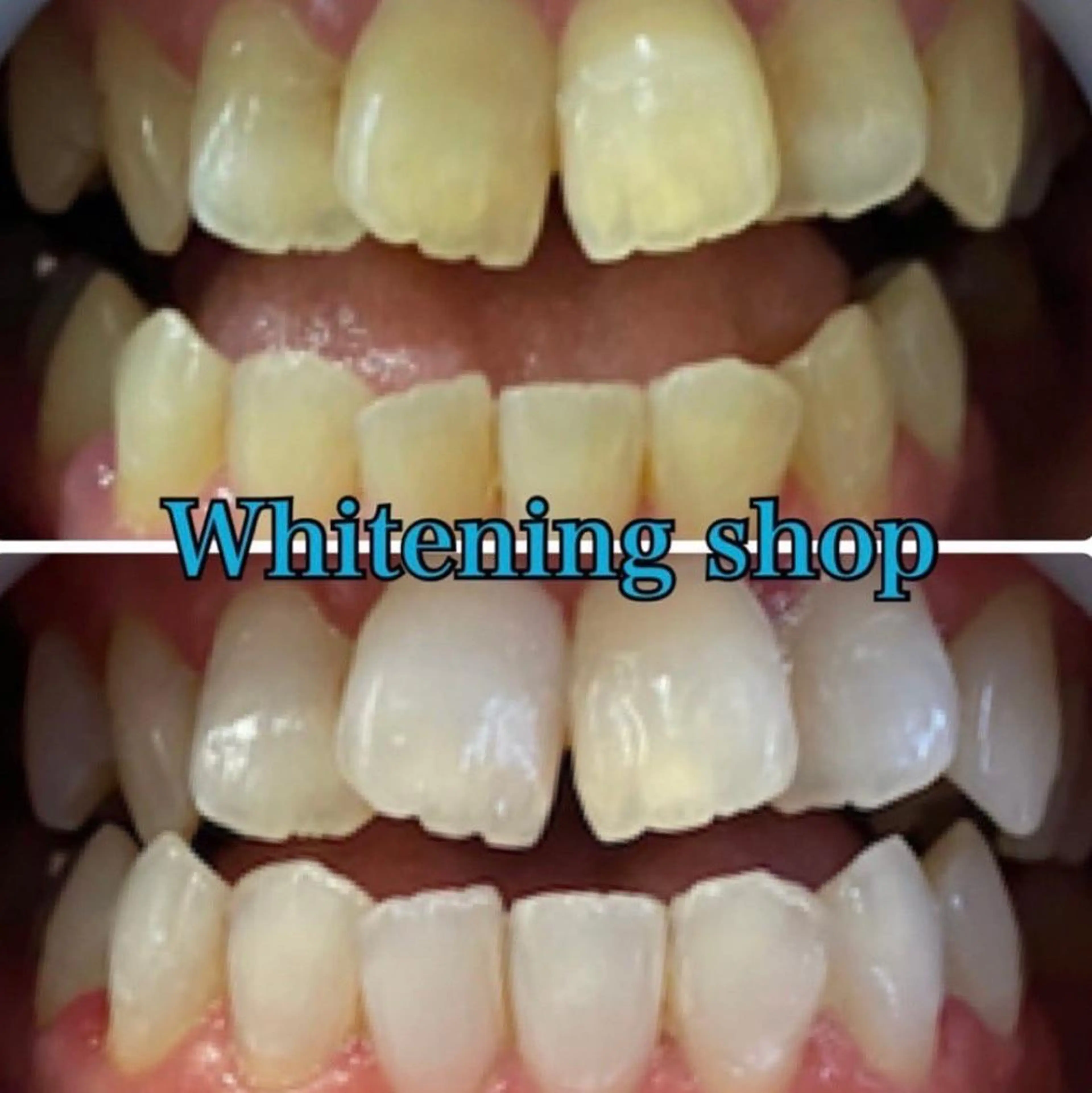 メンズ エステ リラク ホワイトニング ショップ船橋店🦷のエステ・リラクイメージ