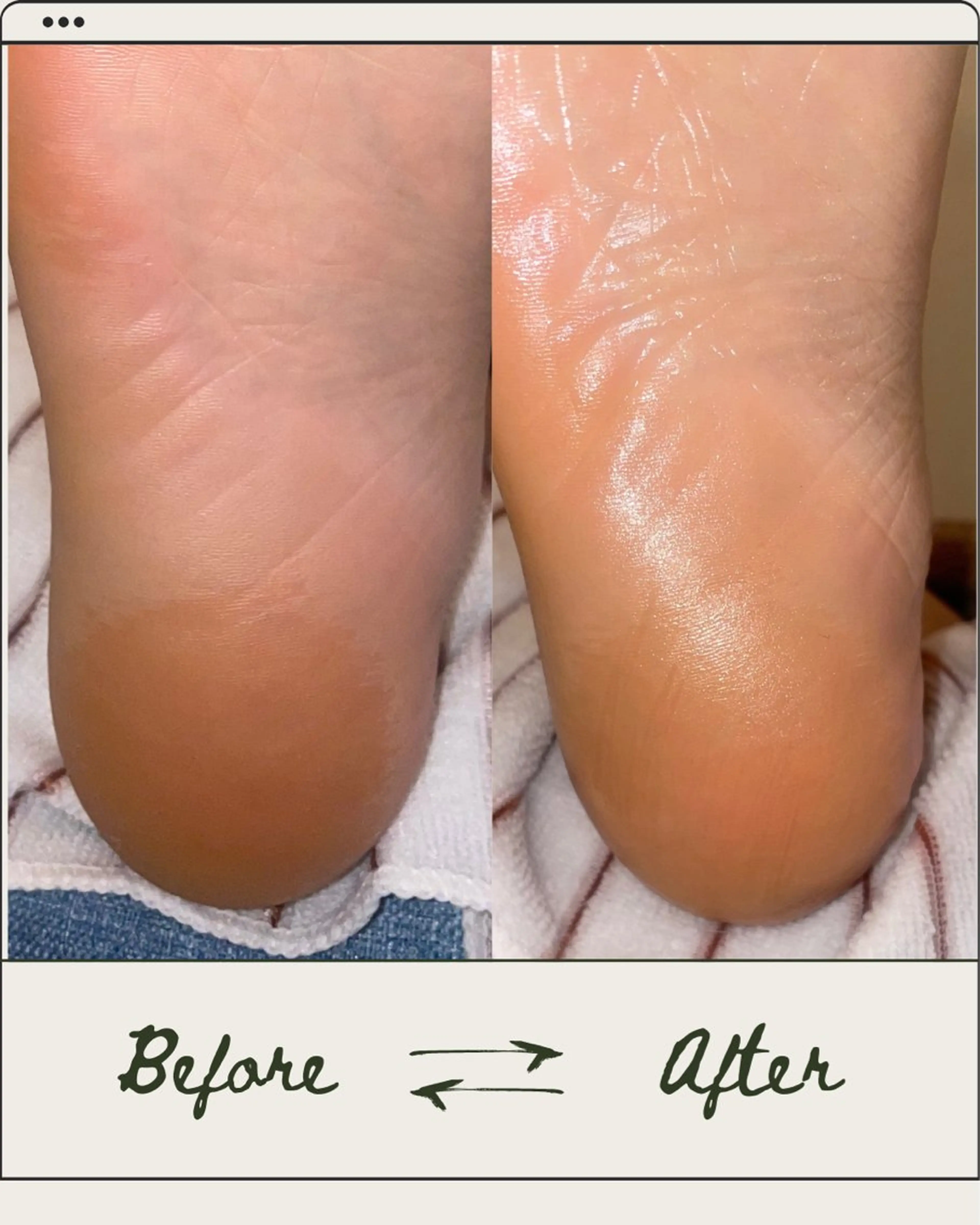 SHARES MADOKAのエステ・リラクイメージ