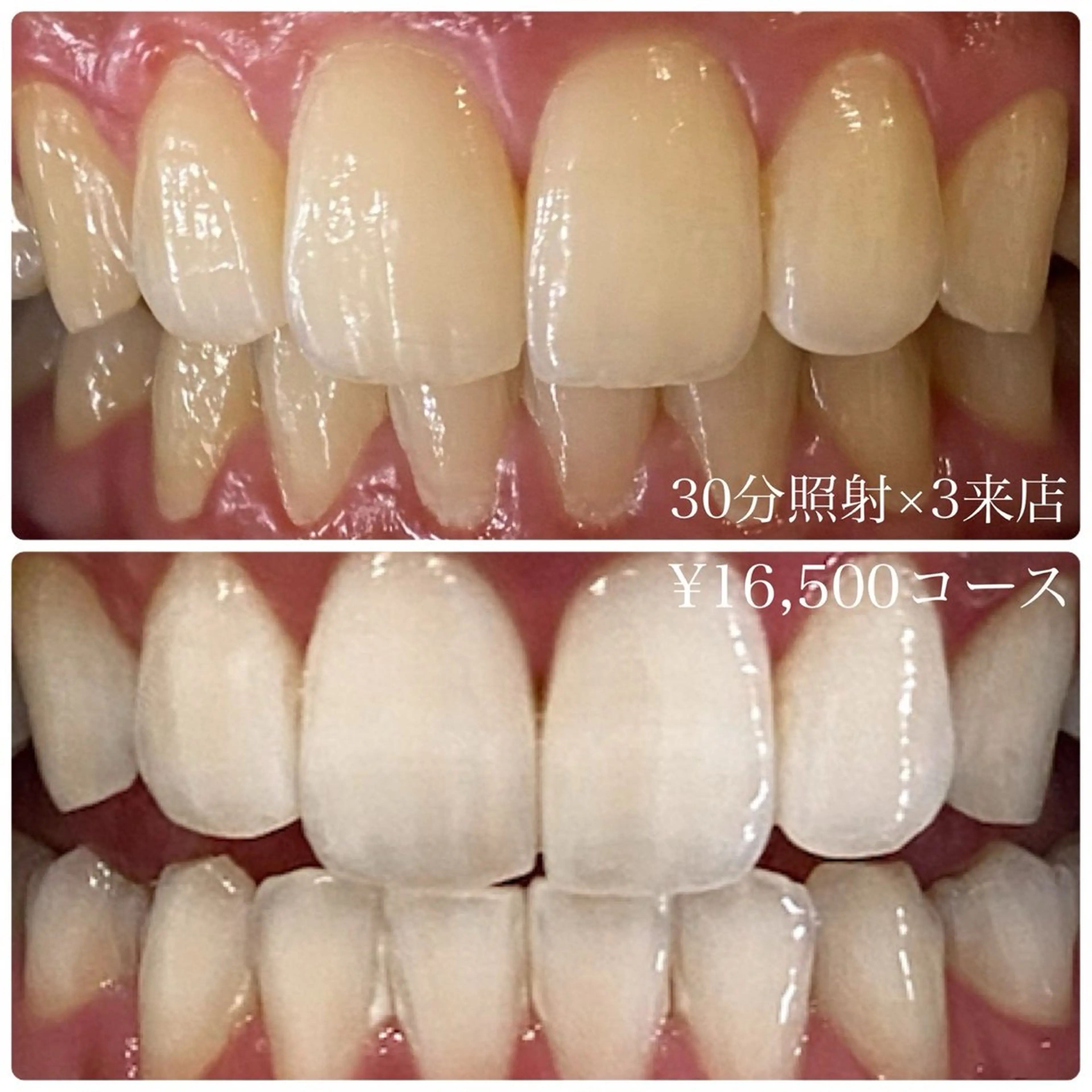 PLATINUM Beauty 横浜店所属・ホワイトニングルーム 横浜店のその他イメージ