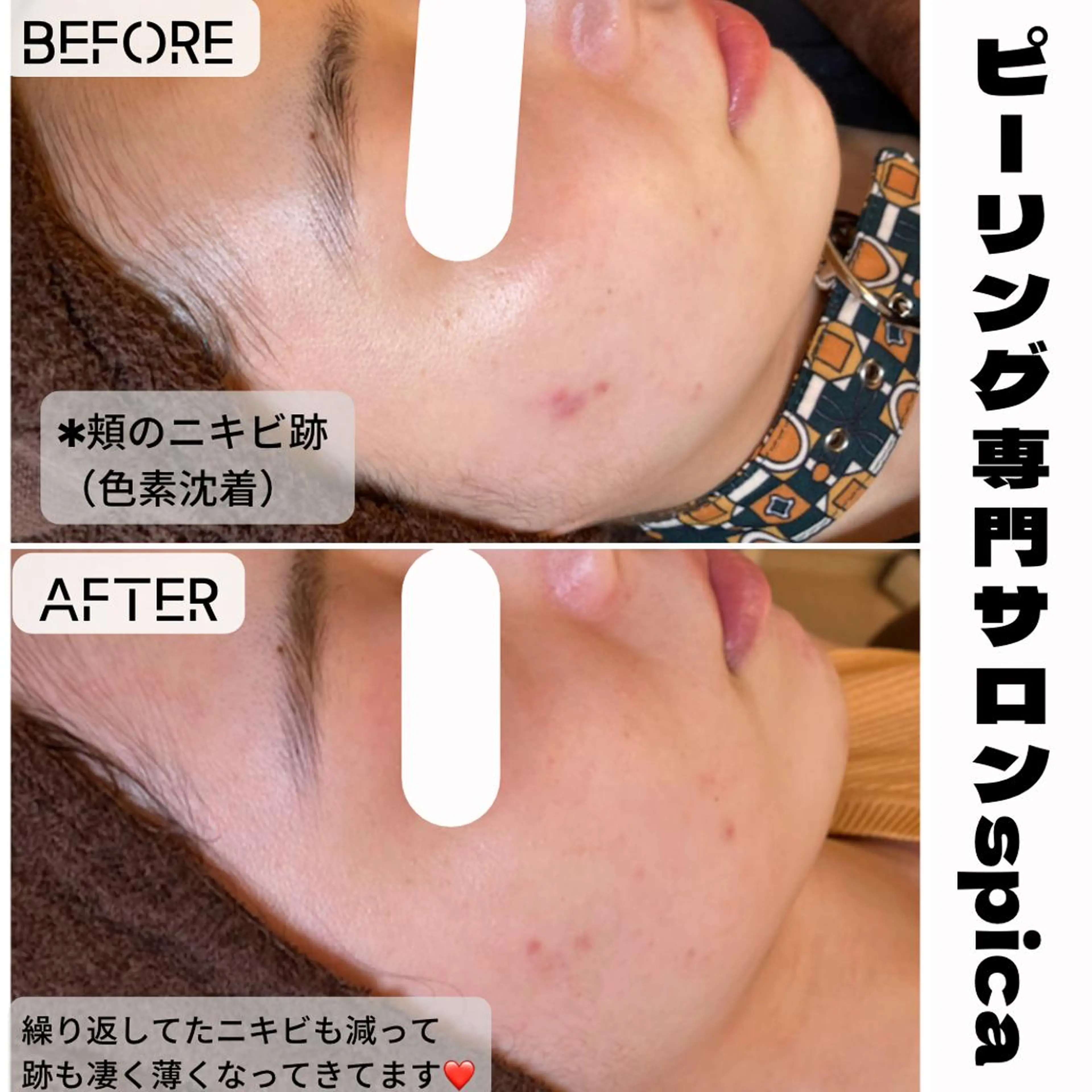 エステ ピーリング専門サロン Spicaのエステ・リラクイメージ