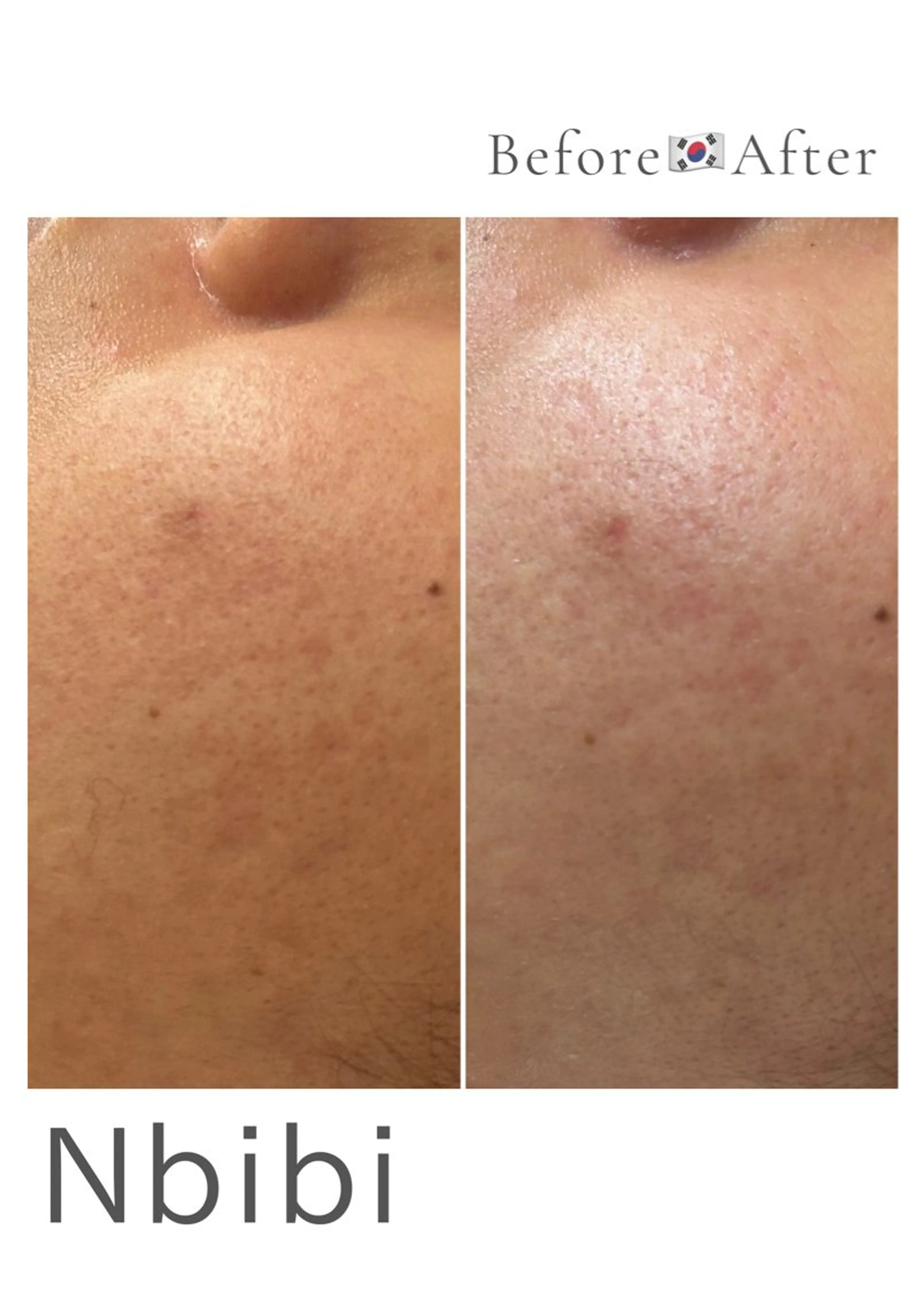 韓国🇰🇷価格 サロン_Nbibiのエステ・リラクイメージ