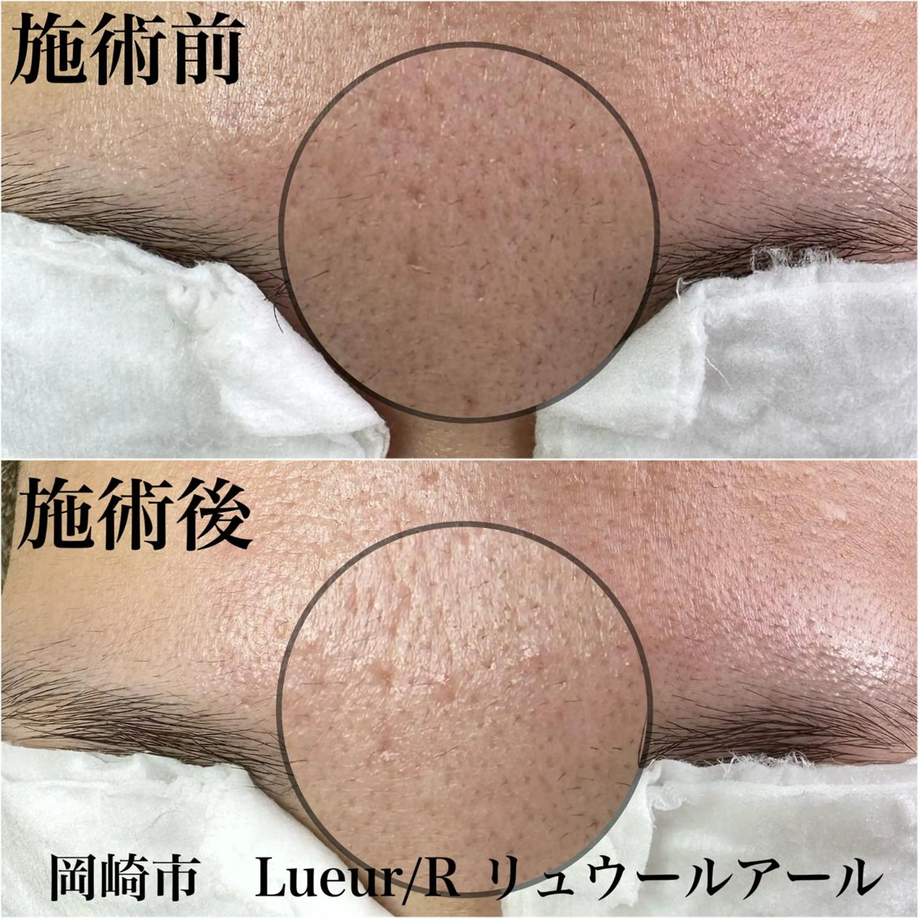 エステ 大久保 里奈のエステ・リラクイメージ