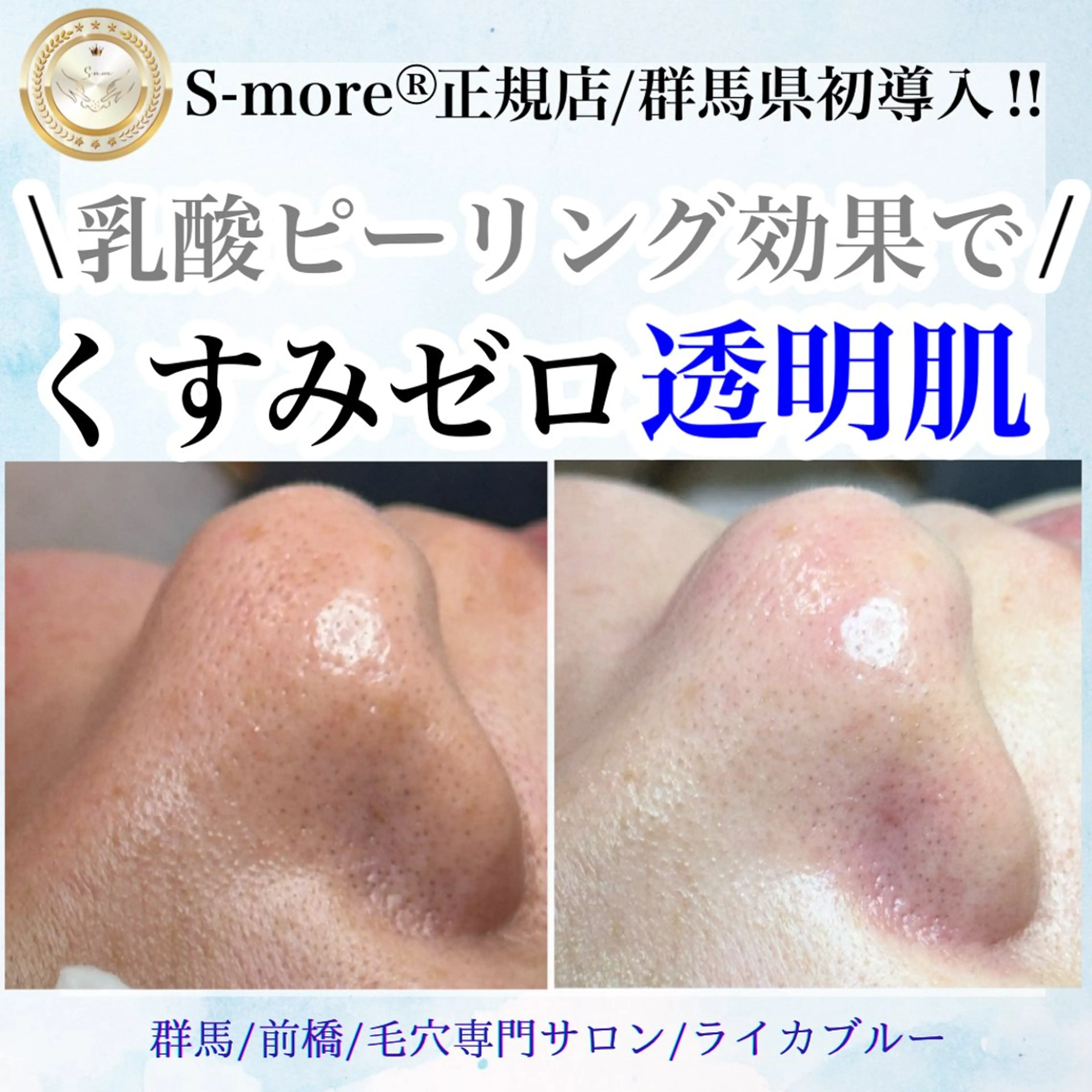 エステ 毛穴専門サロン ライカブルーのエステ・リラクイメージ