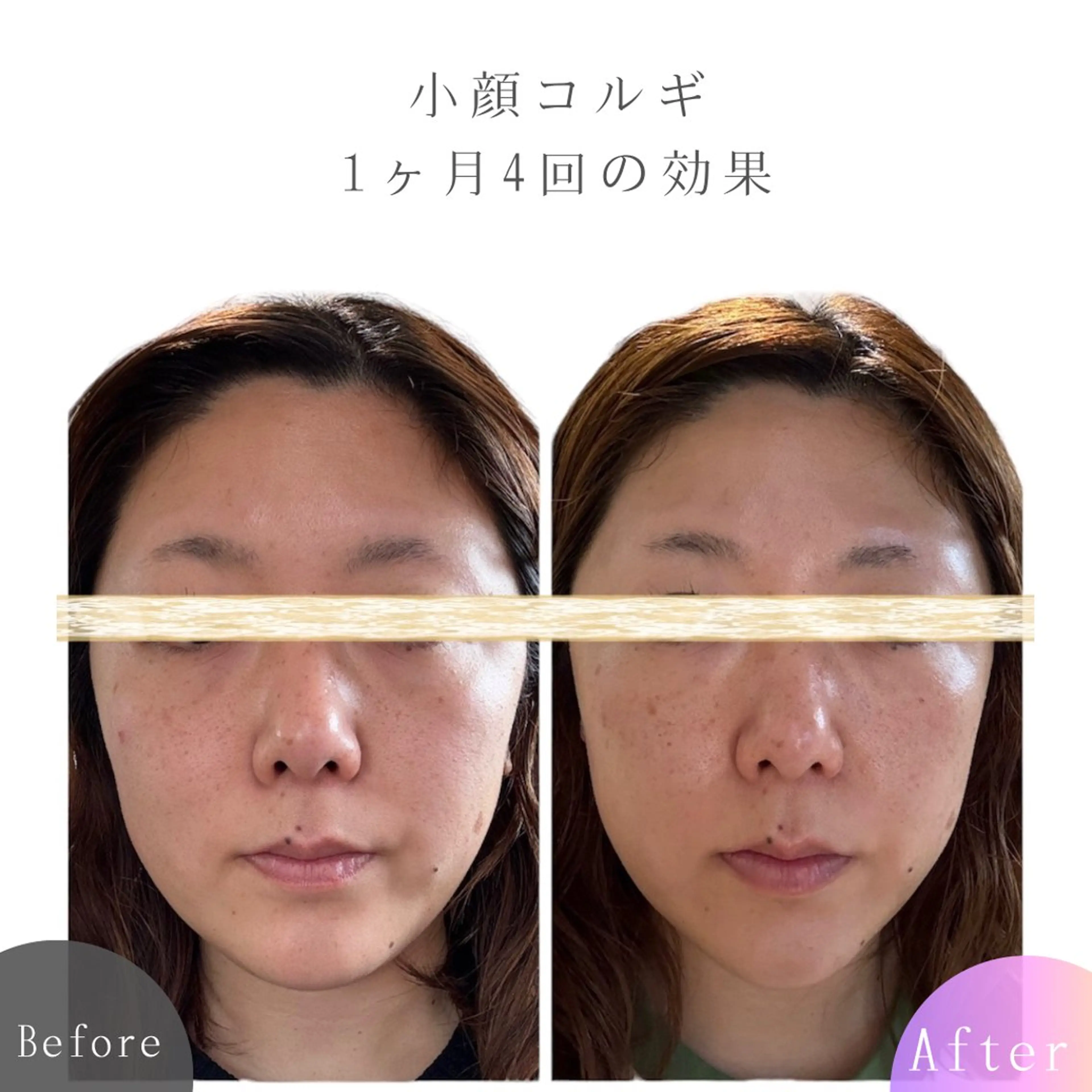 《初回限定》小顔コルギの写真