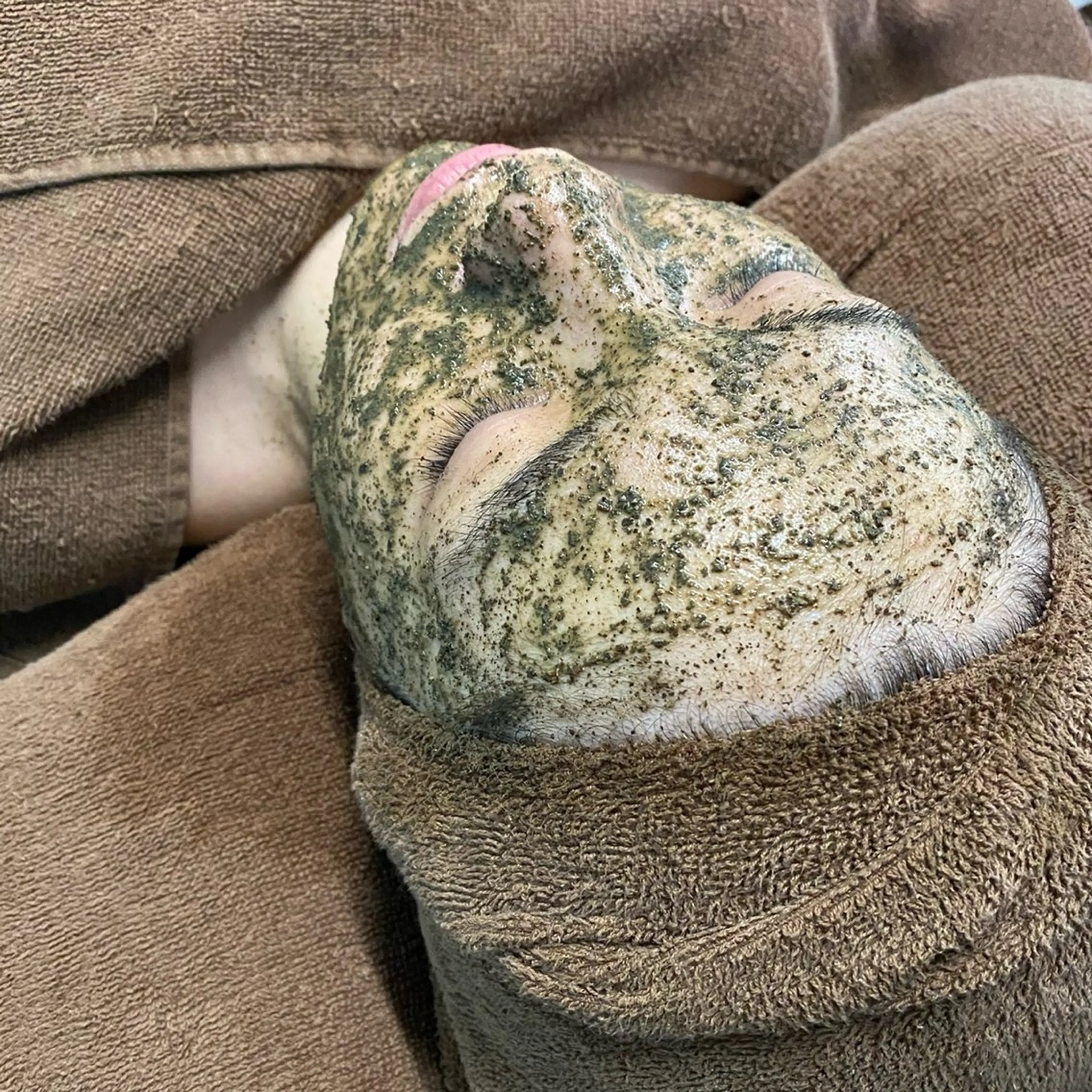 【学生限定/学割U24】肌質改善ハーブピーリング★シミ、ニキビケア、肌荒れオプション付き🎁の写真