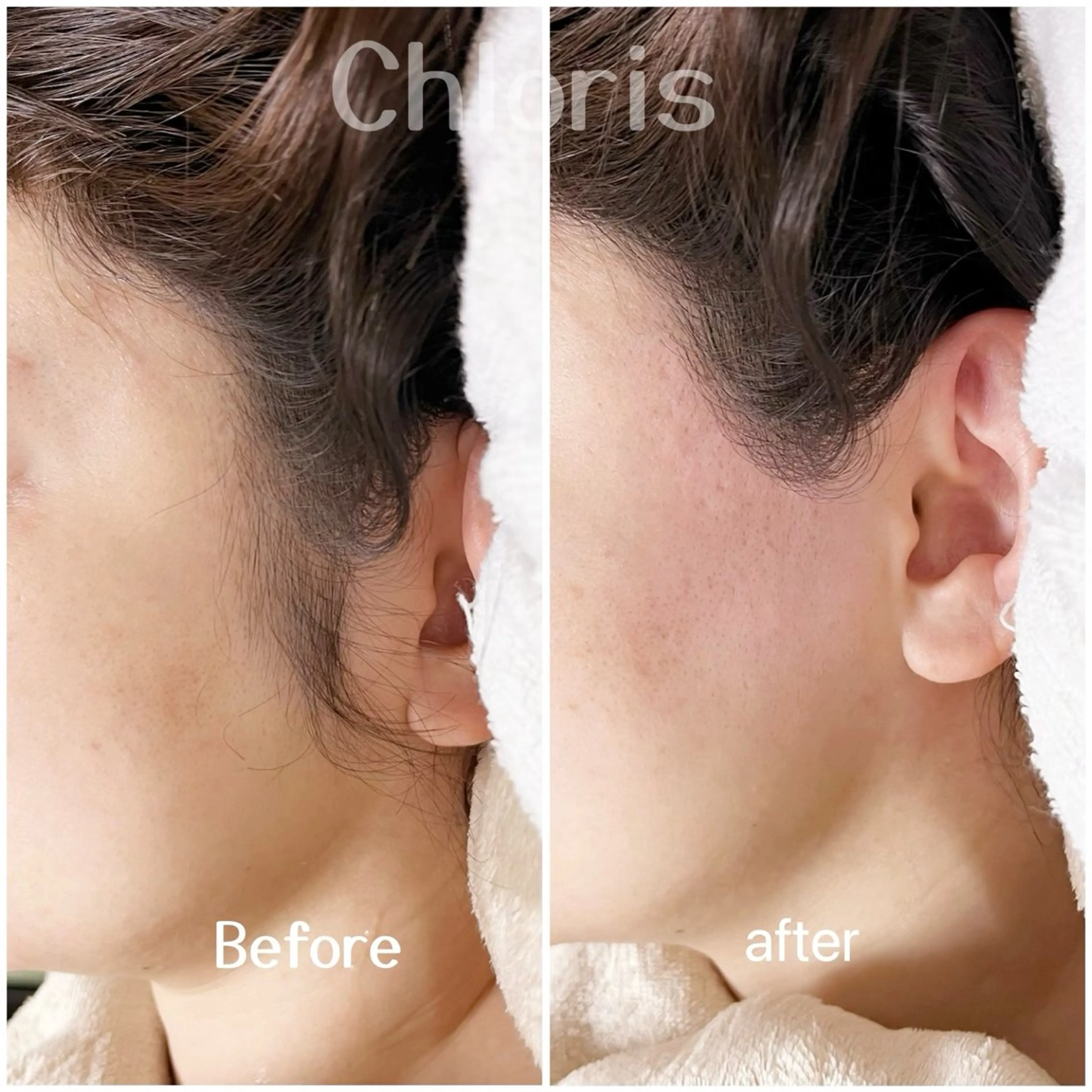 川越ローマピンク 光脱毛＆ワックス脱毛のエステ・リラクイメージ