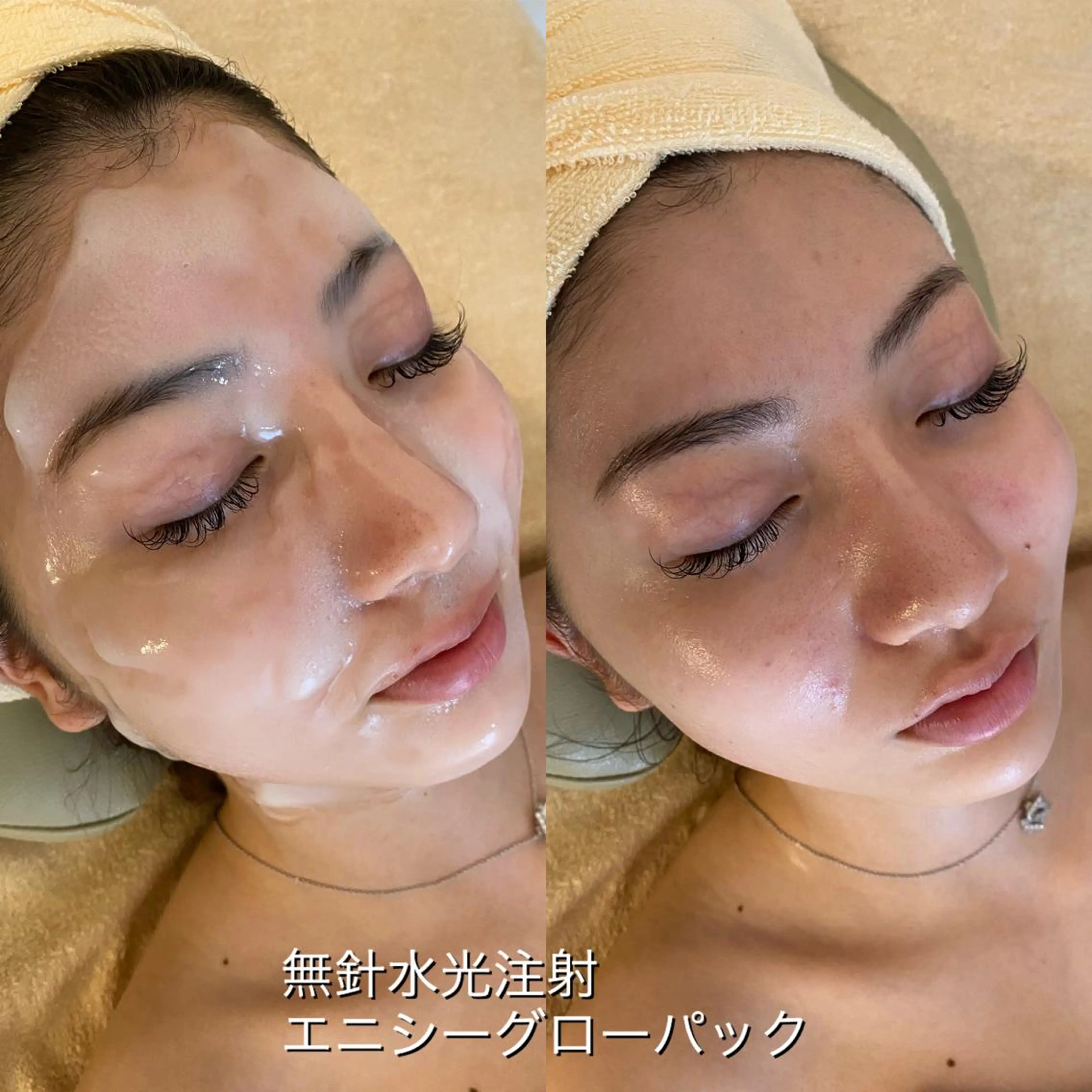 うなじ脱毛/美肌脱毛 LABELのエステ・リラクイメージ