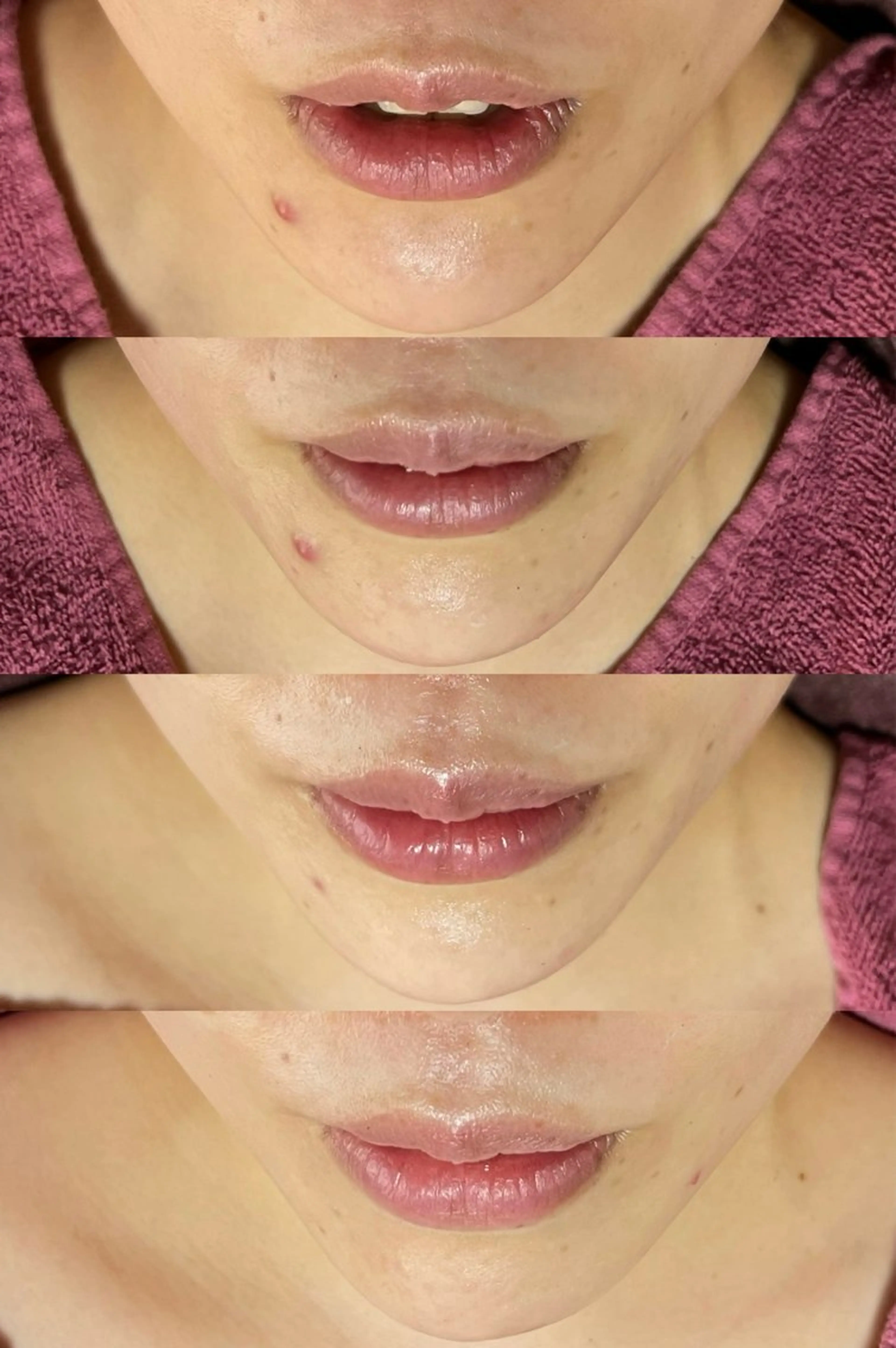 エステ 脱毛和みサロン新茶屋所属・脱毛和みサロン新茶屋 ひろみ（女性専用）のエステ・リラクイメージ