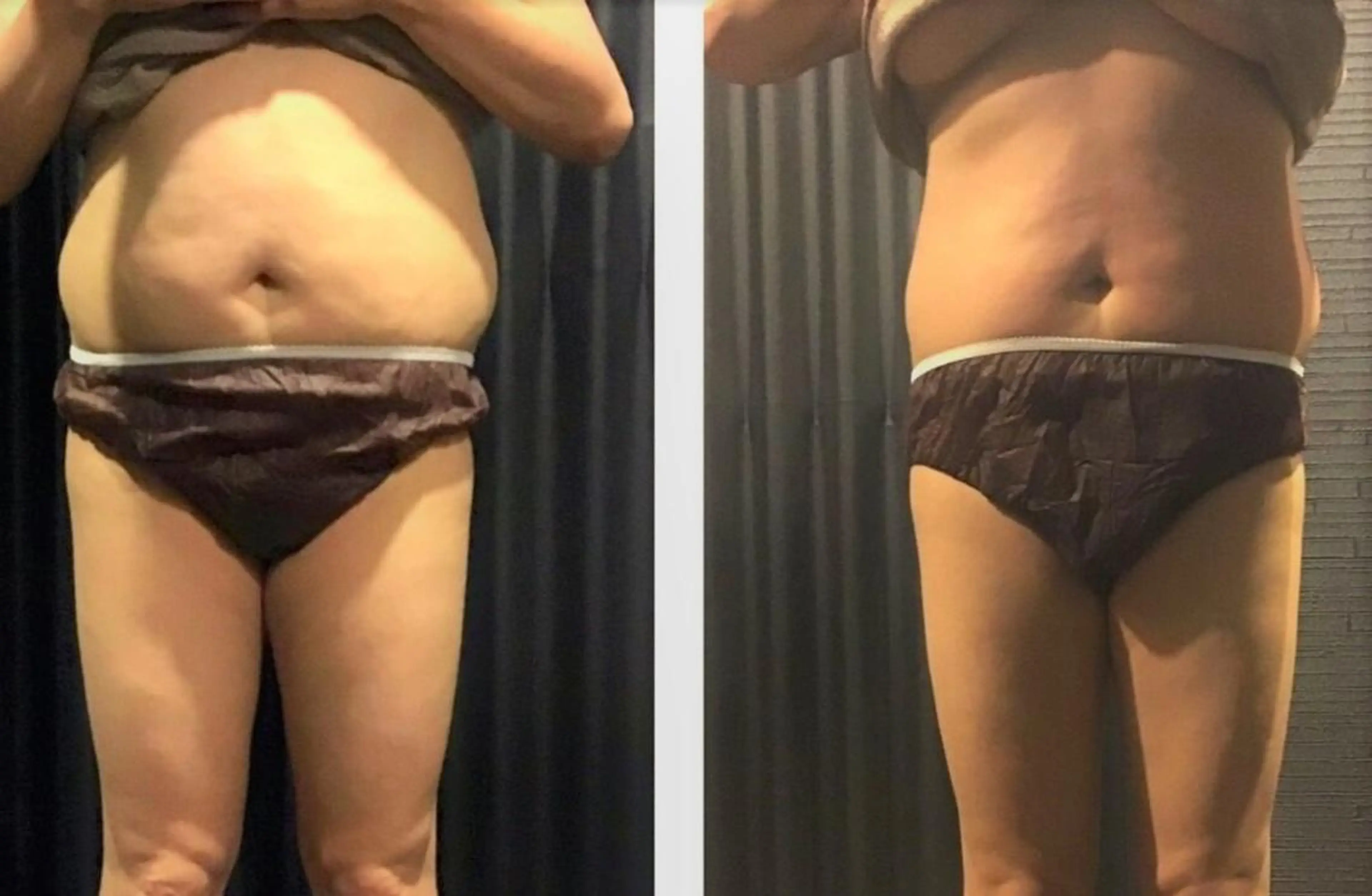 横浜エステサロン R-ing リングのエステ・リラクイメージ