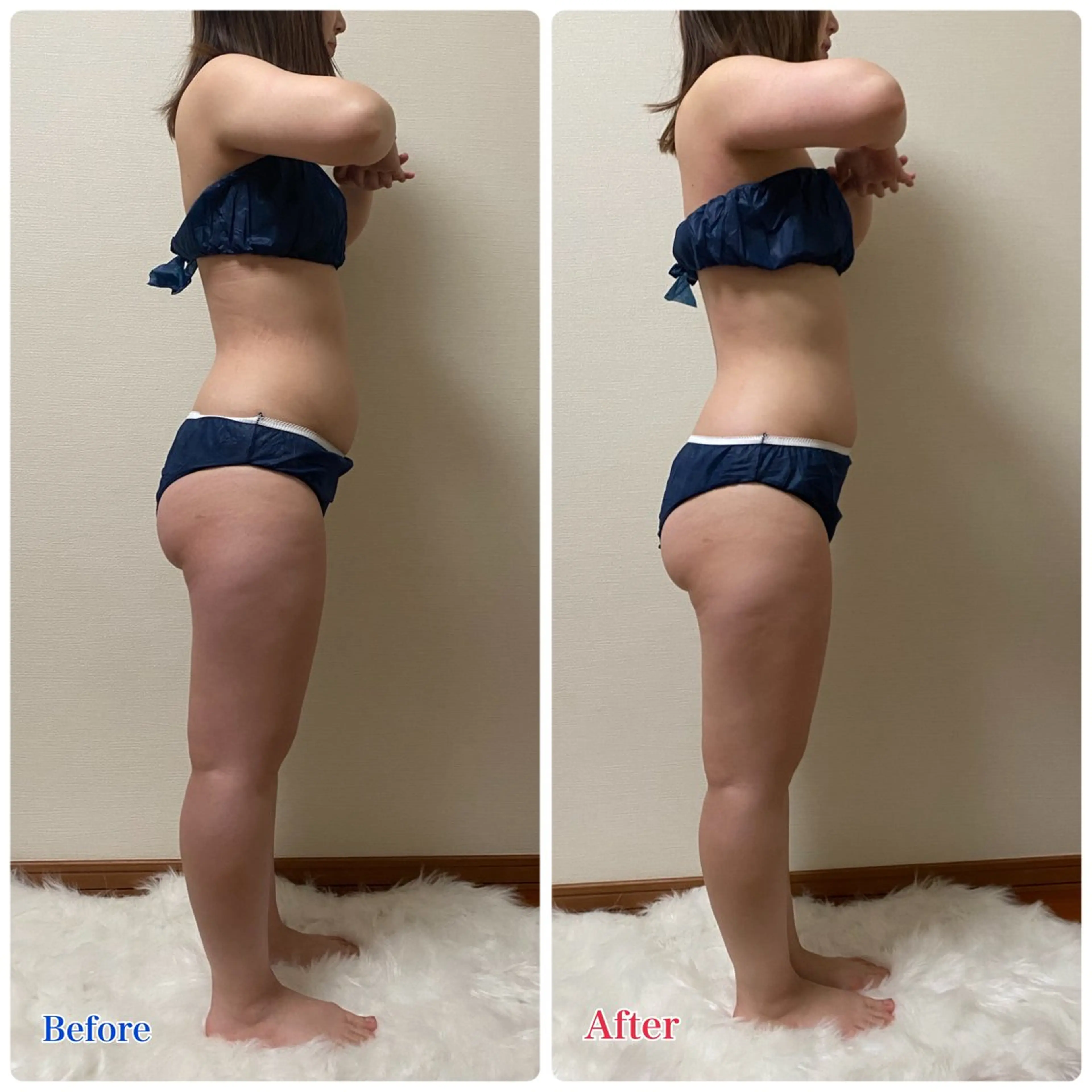 エステ ACORAL痩身 NAZUKIのエステ・リラクイメージ