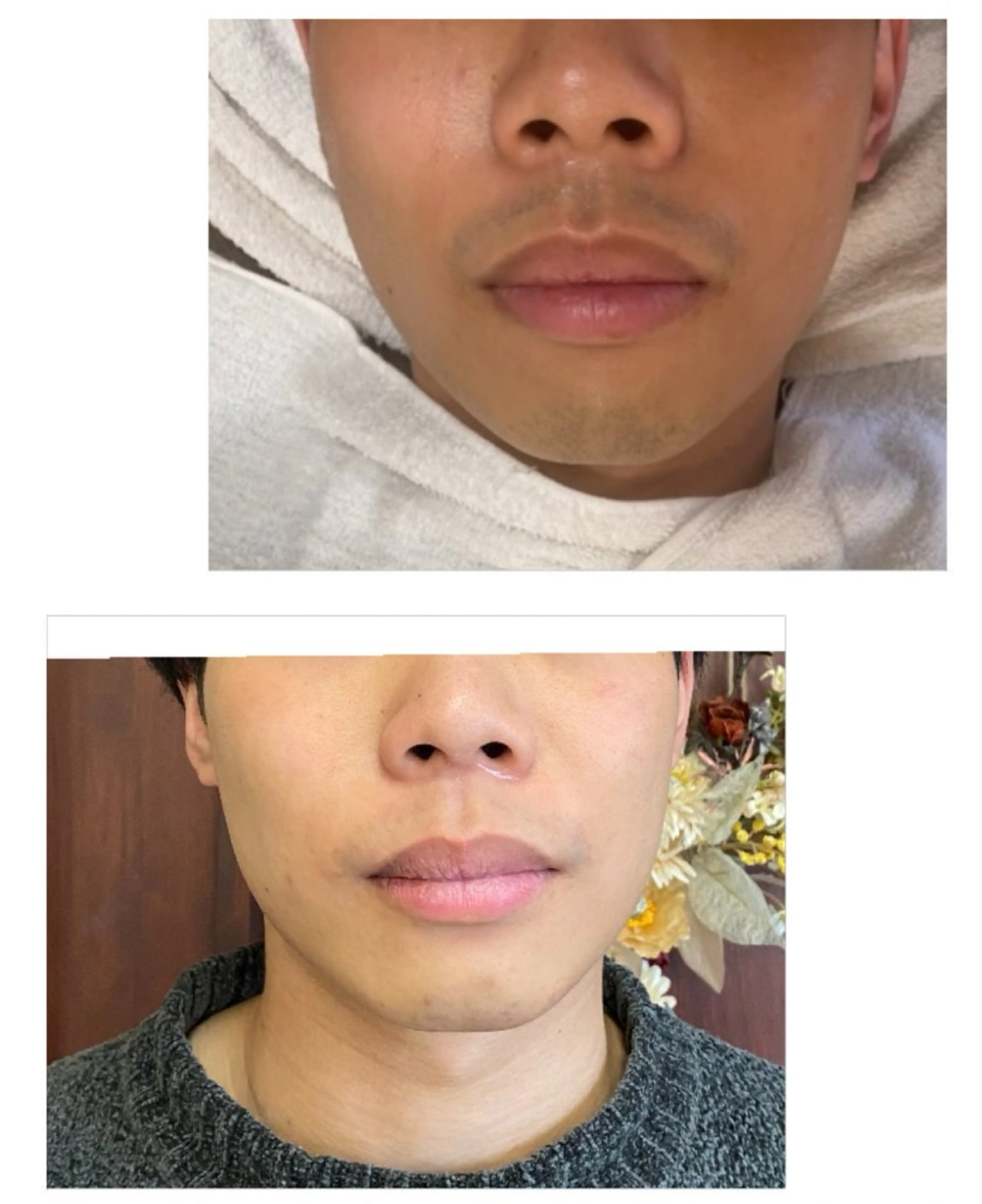 脱毛 ネイル＆脱毛 Lotus🌸のネイルデザイン