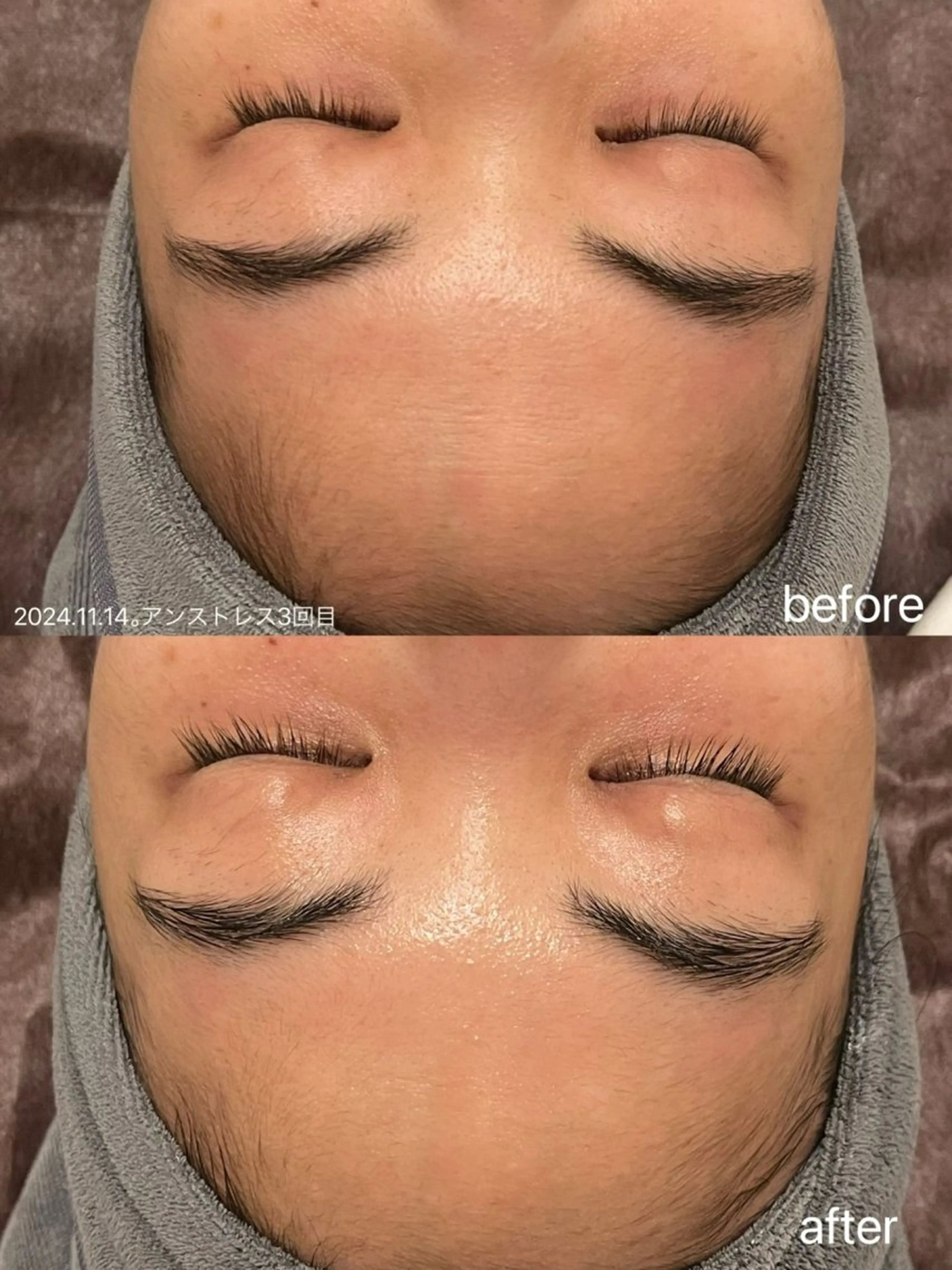 マツエク・マツパ エステ リラク 小顔＆まつ毛サロン AKANE❤️のエステ・リラクイメージ