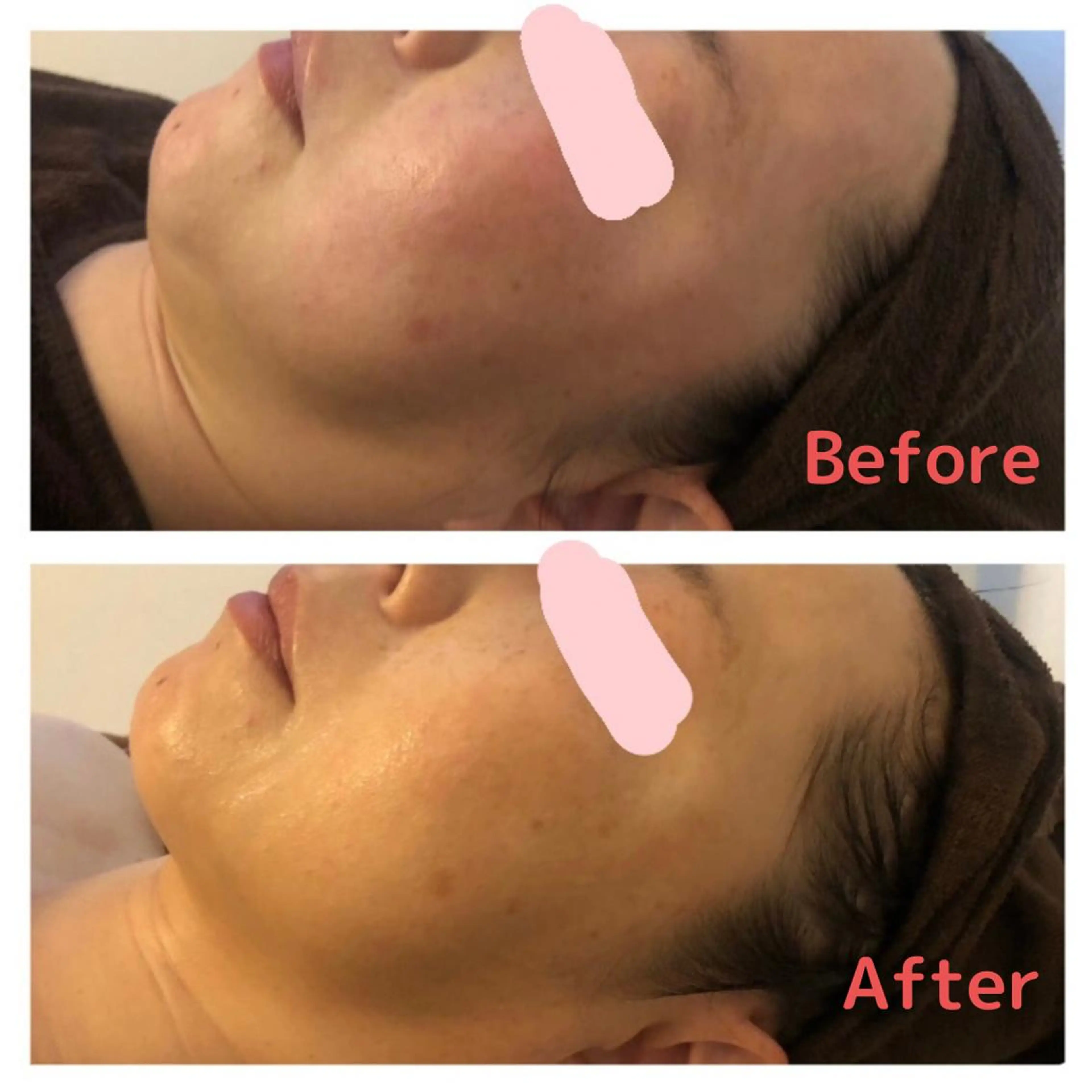 痩身専門サロン ビューティーグランツのエステ・リラクイメージ