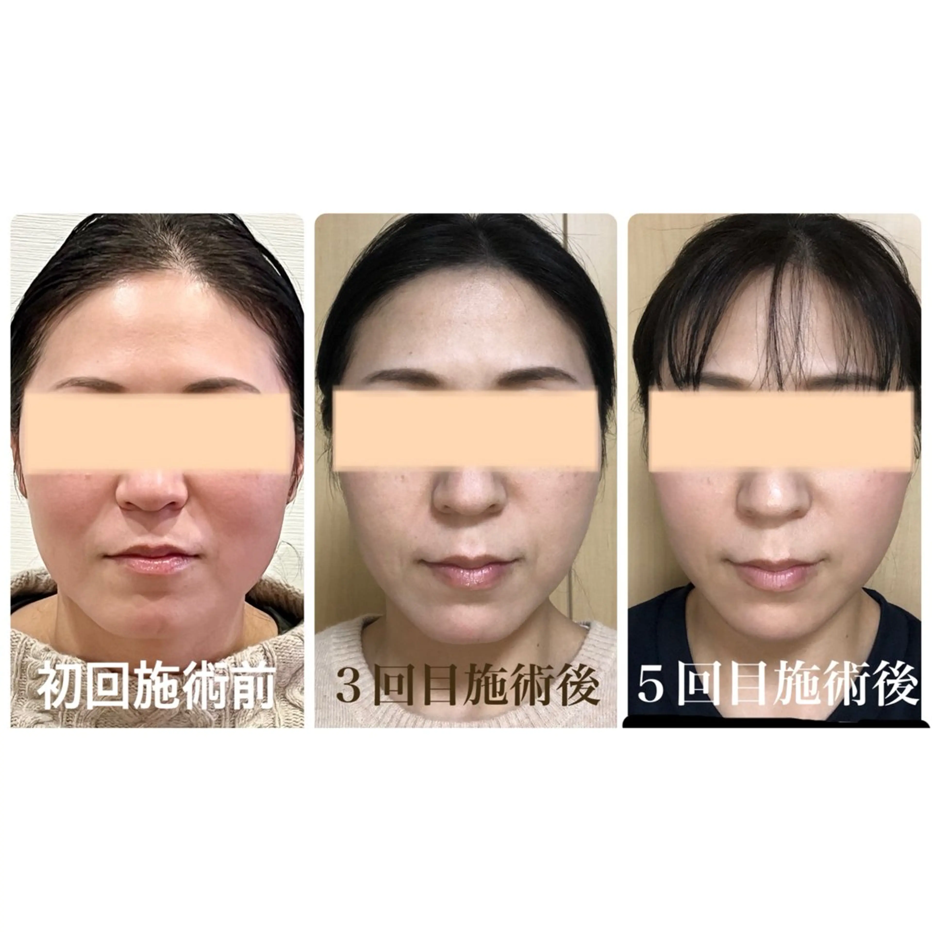 Cream 福井のエステ・リラクイメージ