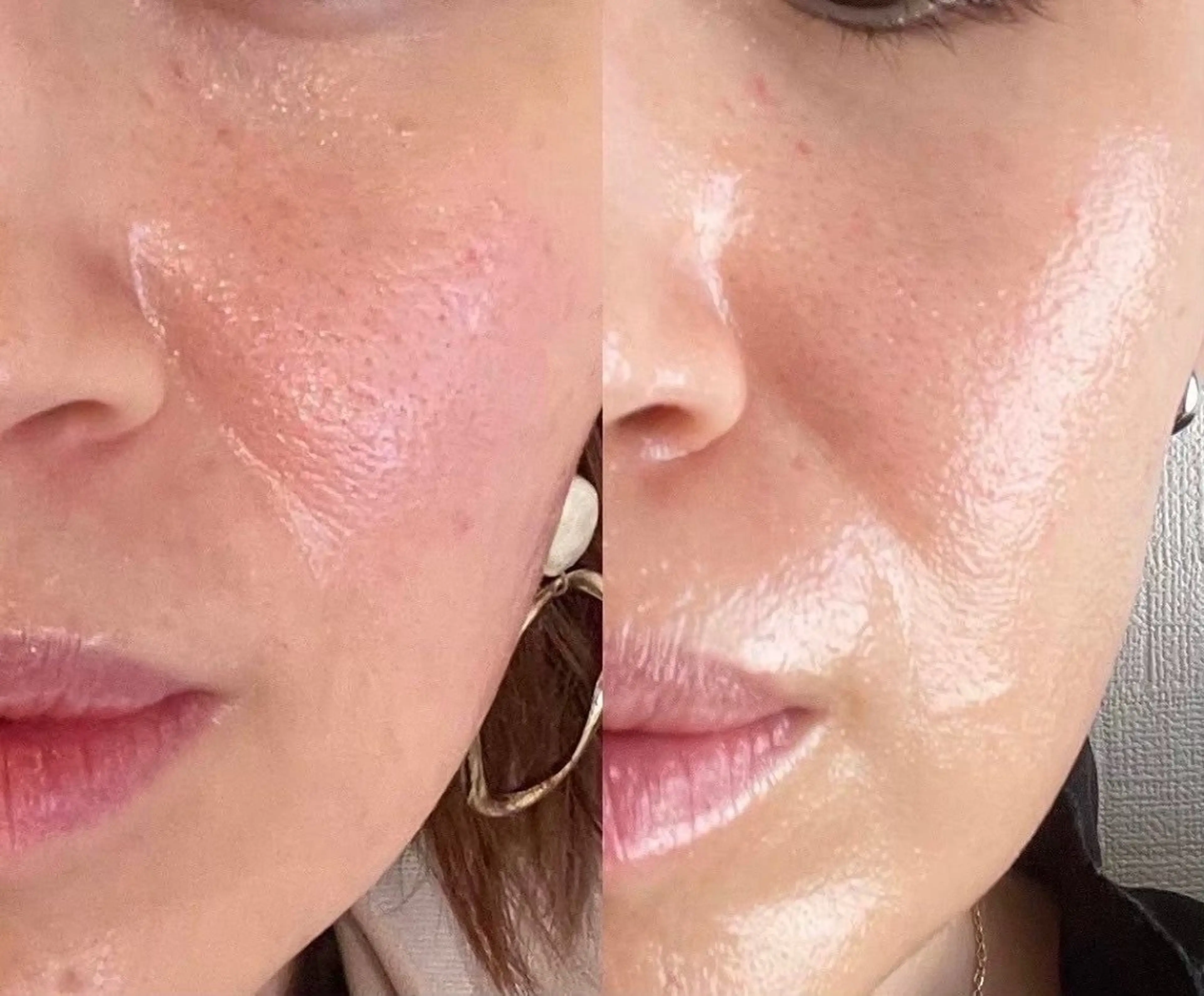 【艶玉】3種のフレッシュ幹細胞＋毛穴洗浄の写真