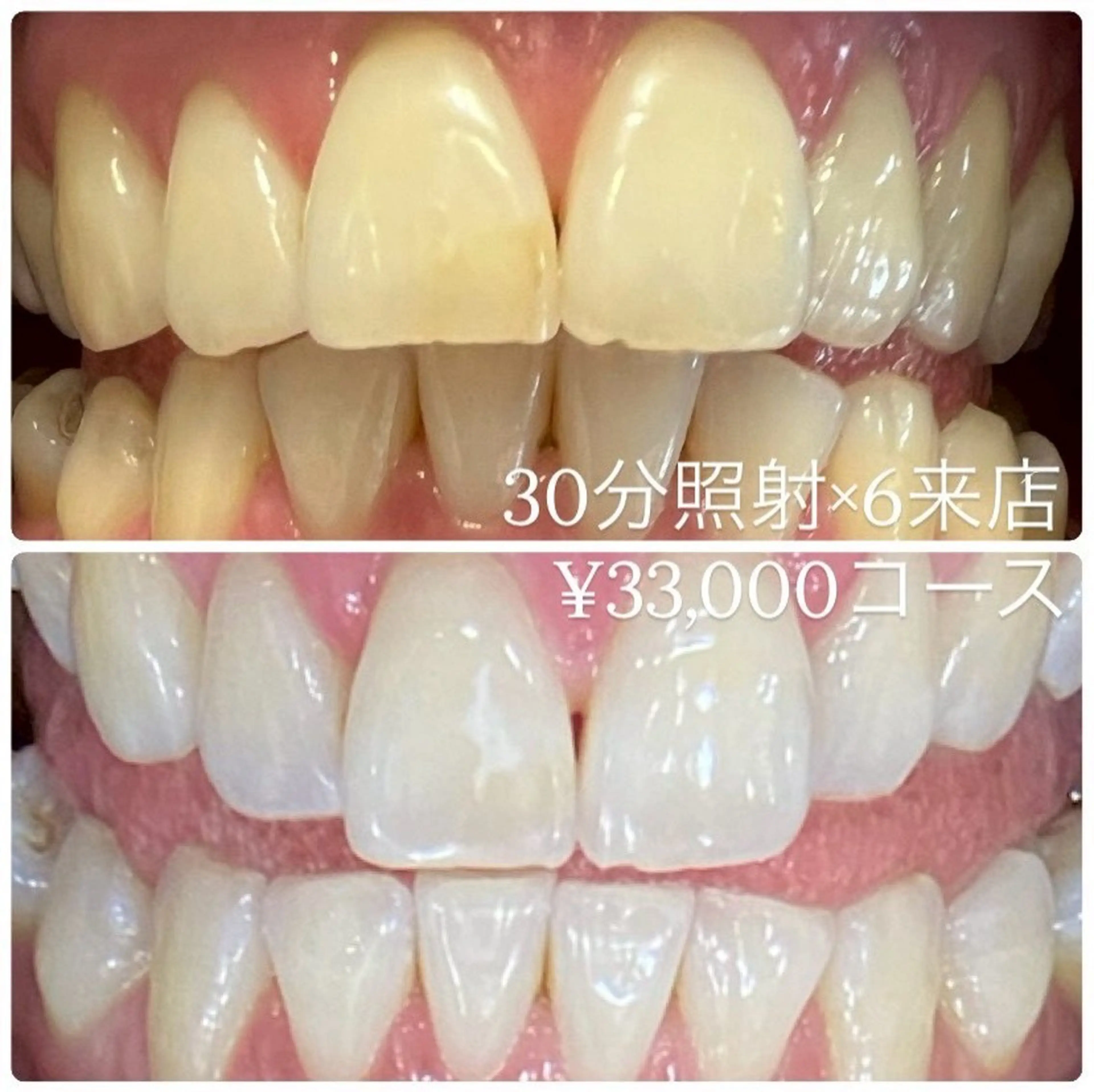 メンズ その他 ホワイトニングルーム　川崎店所属・ホワイトニング ルーム　川崎店のその他イメージ