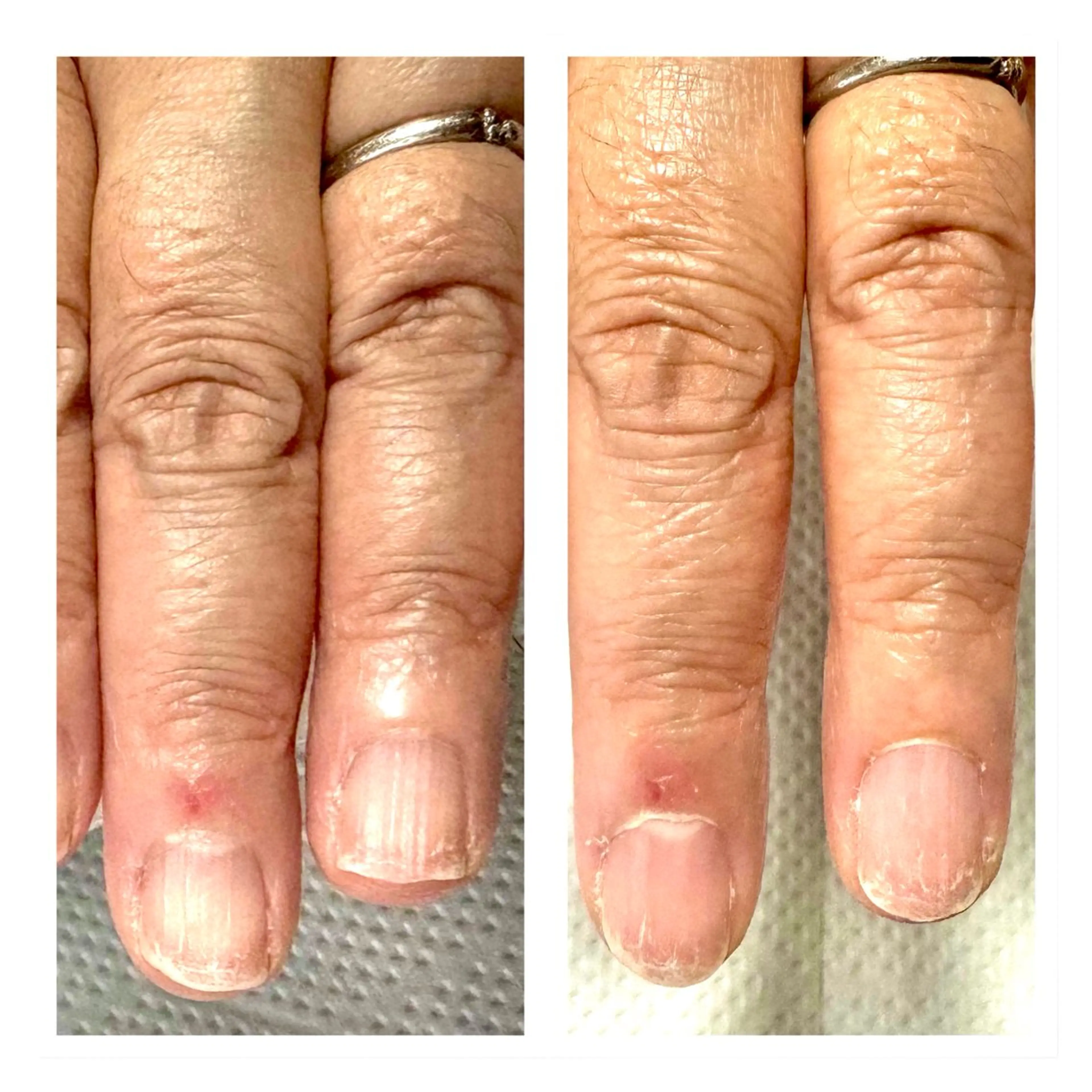 究極のネイルケアの写真