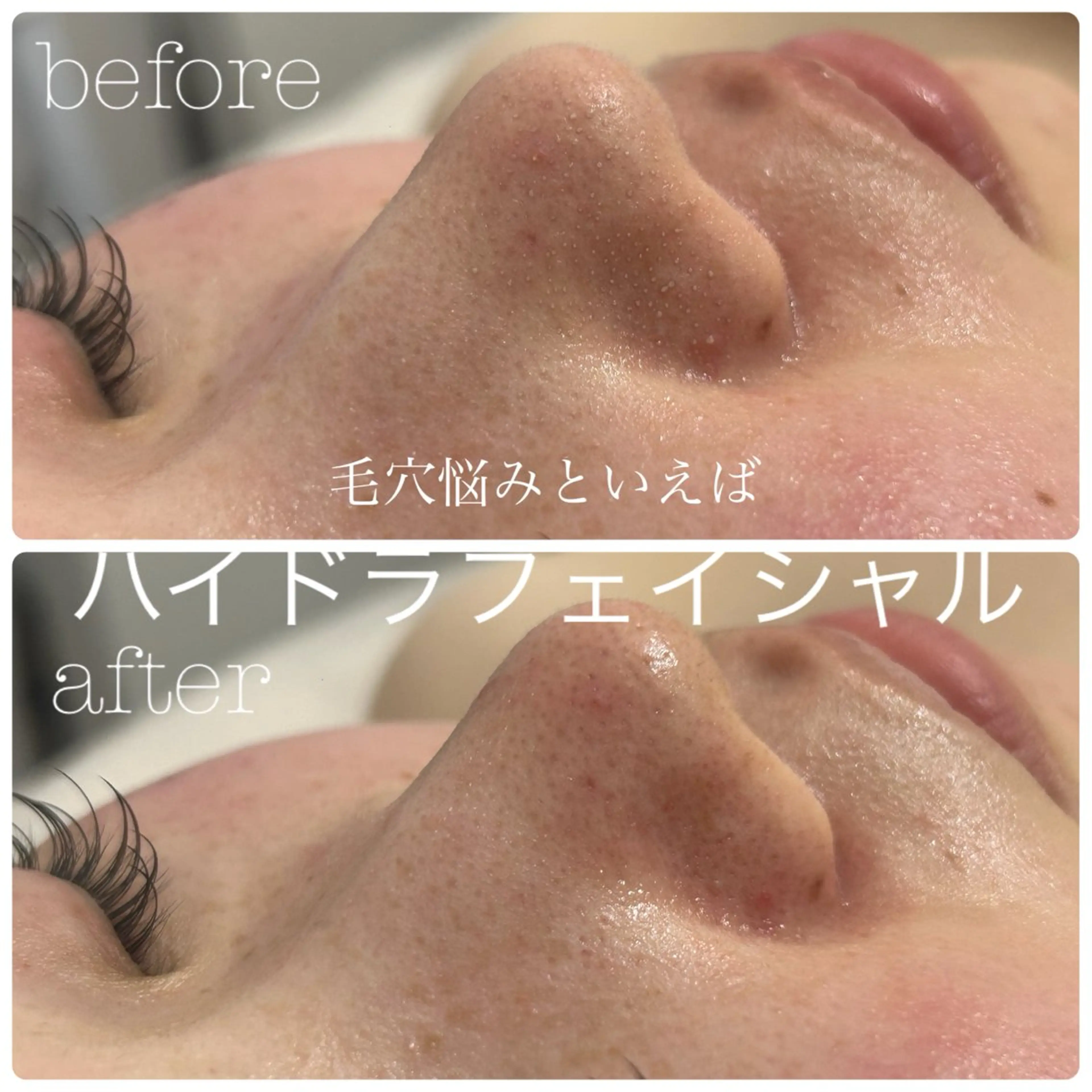 エステ フェイシャルサロン CHIARA 荒田のエステ・リラクイメージ