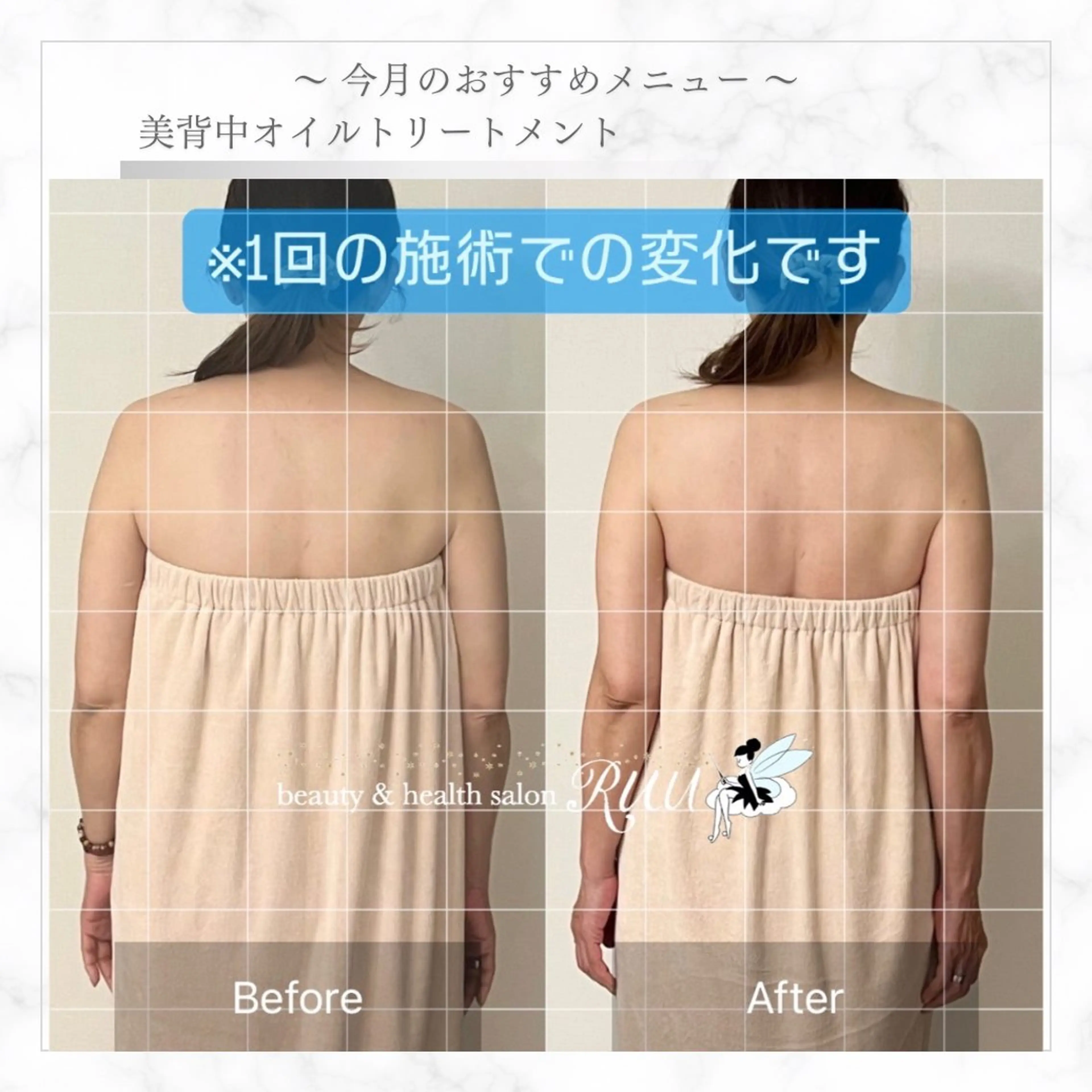 【頭痛、睡眠改善】 salon RUUのエステ・リラクイメージ