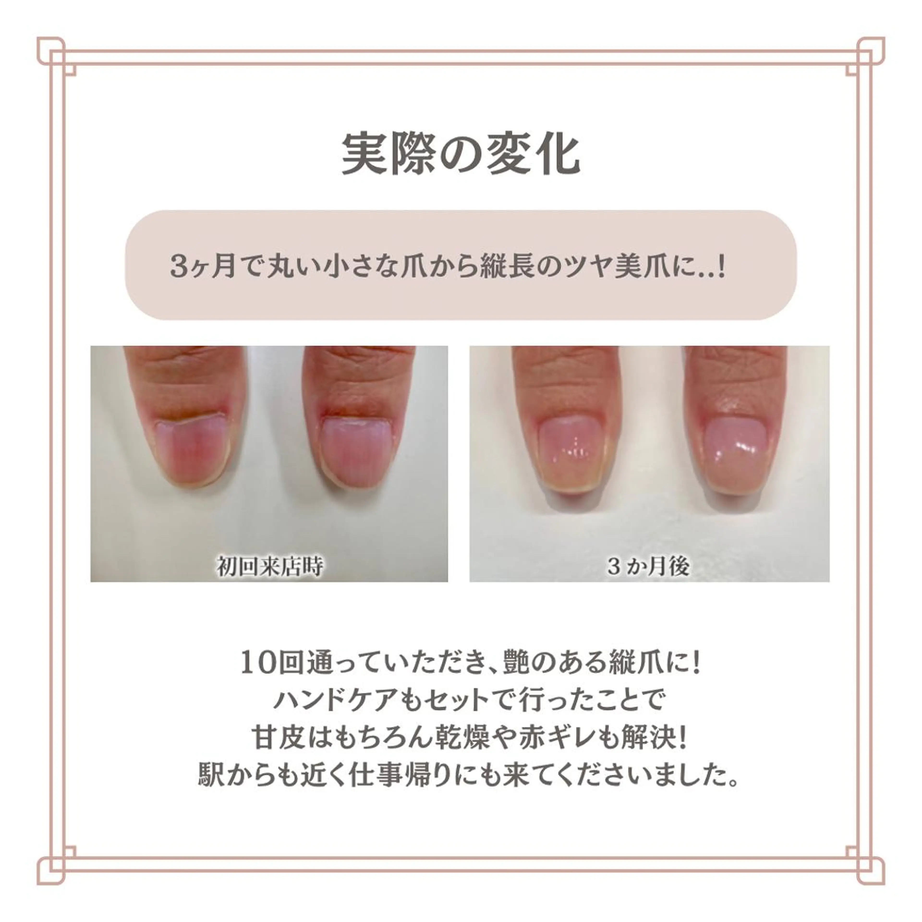 ネイル 自爪育成専門サロン エムロードゥ池下のネイルデザイン