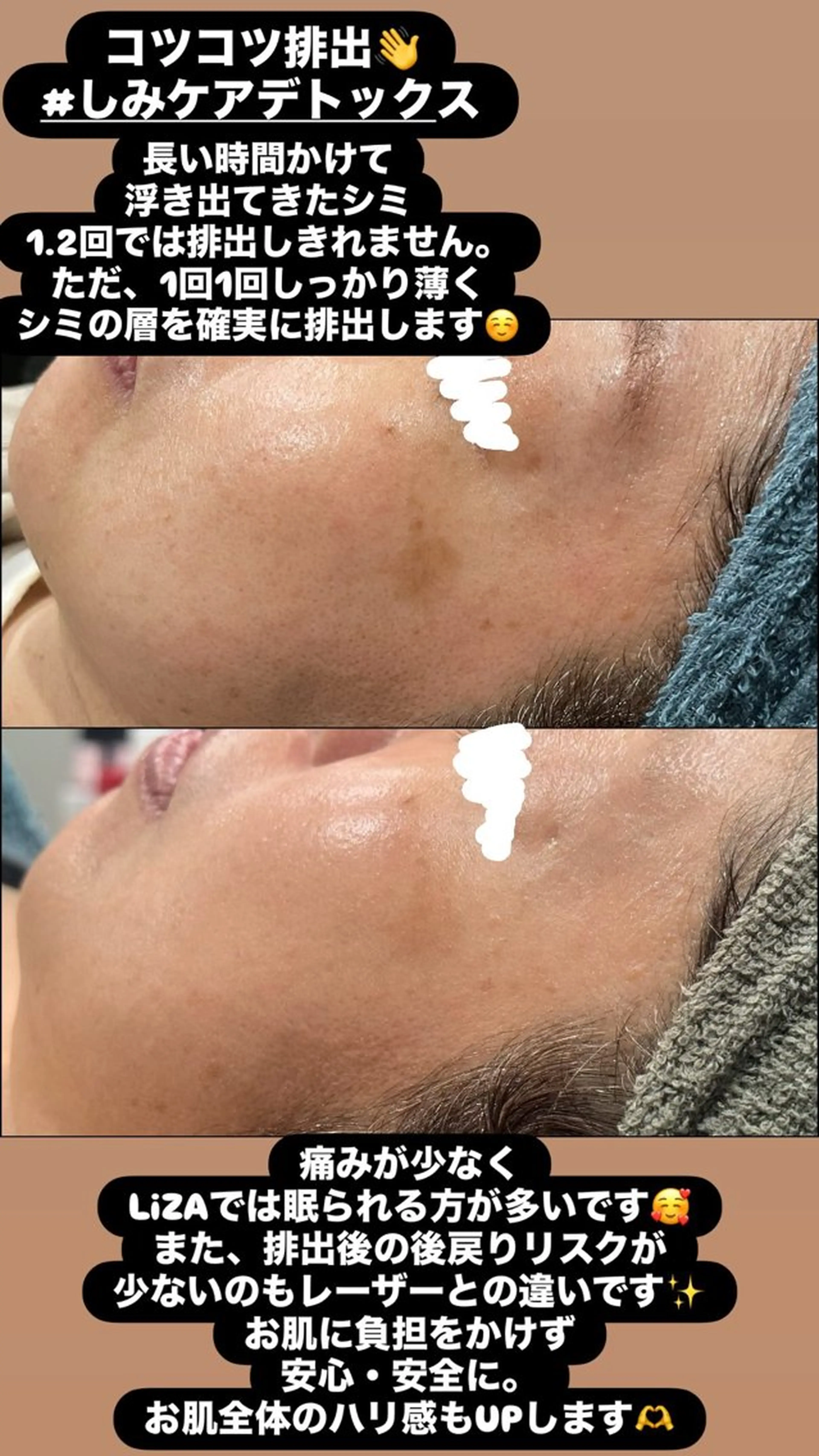 エステ LiZA エステティックサロンのエステ・リラクイメージ