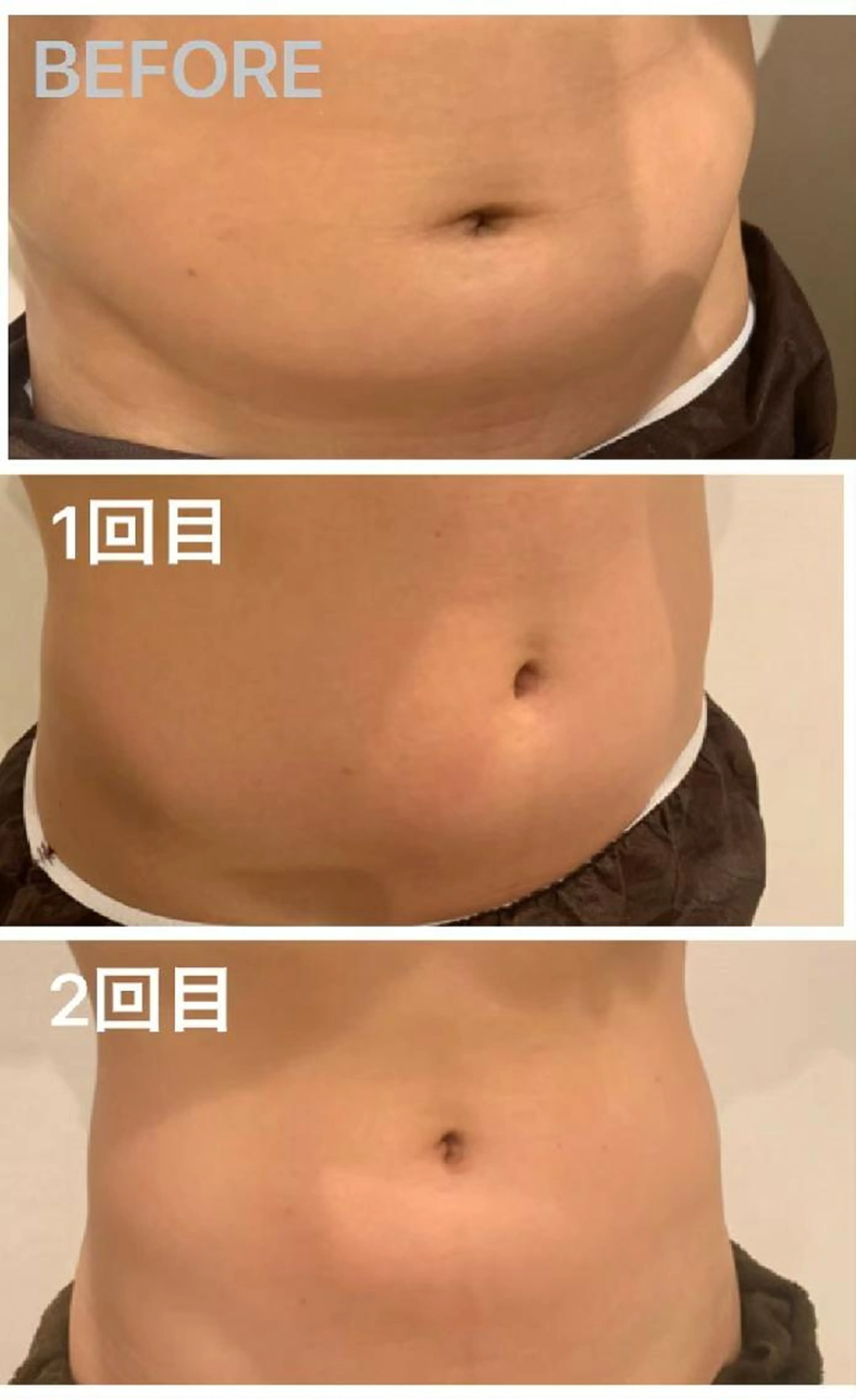 ほっこりお腹撃退の写真