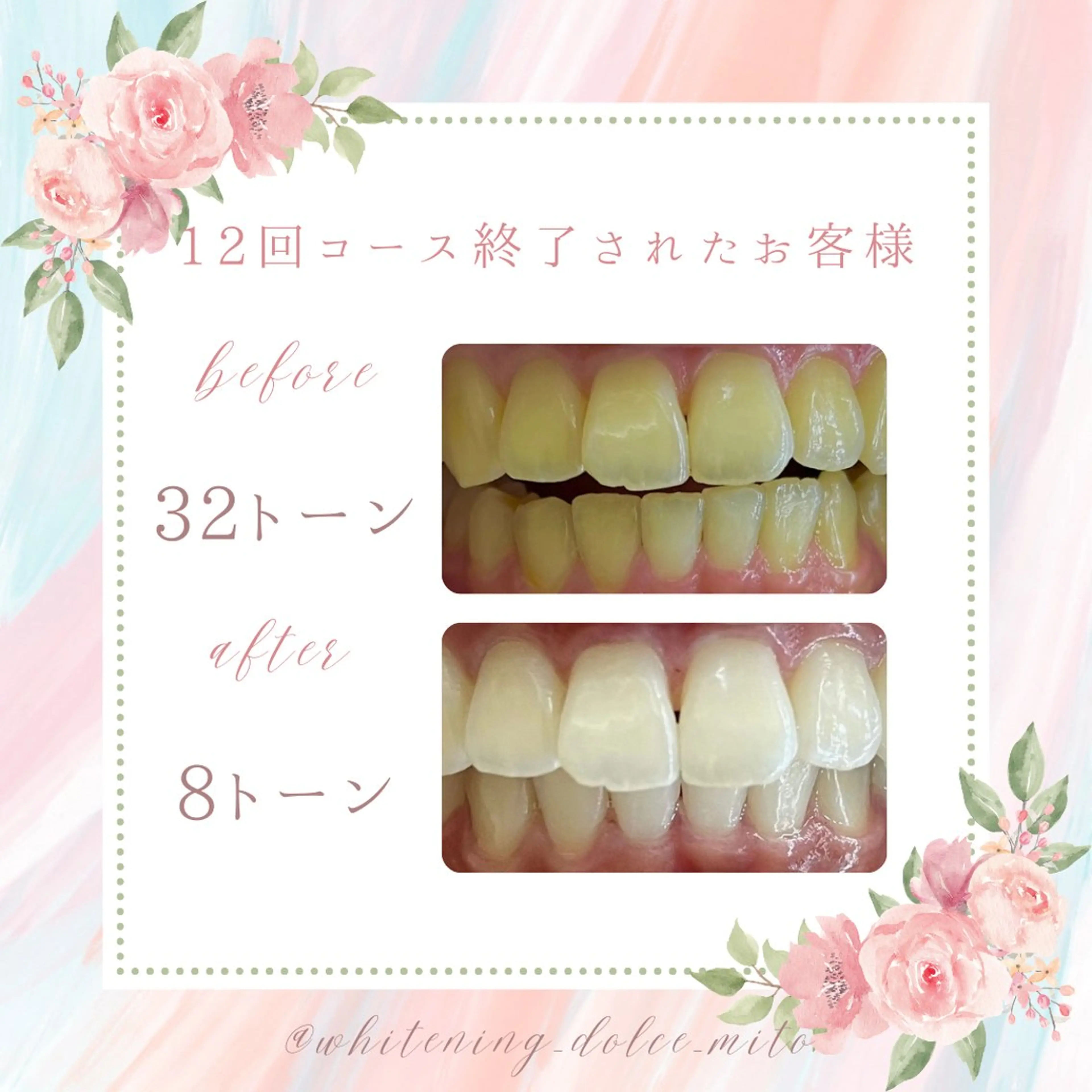 セルフホワイトニング Dolce水戸店のその他イメージ