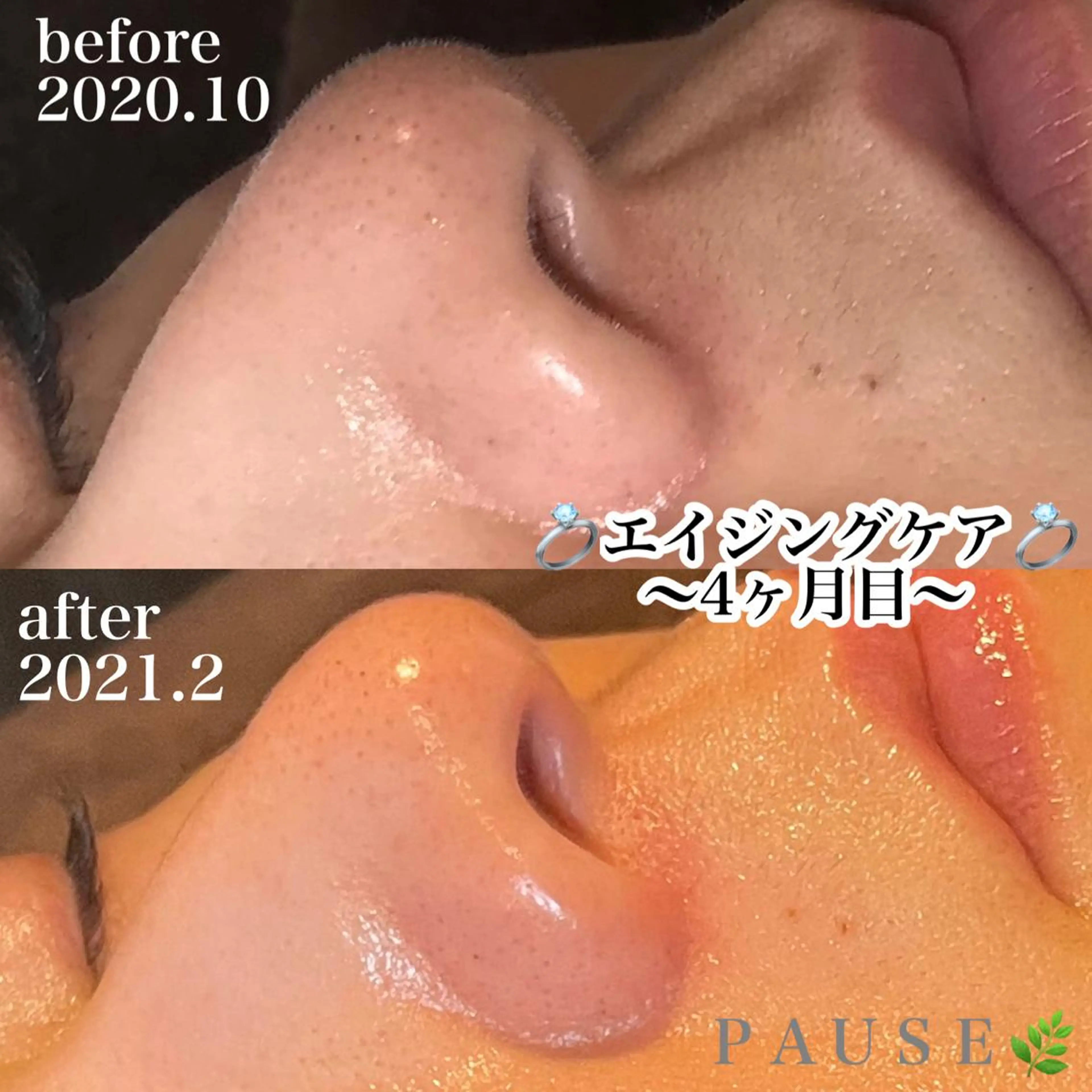 エステ 浜野 恵美のエステ・リラクイメージ