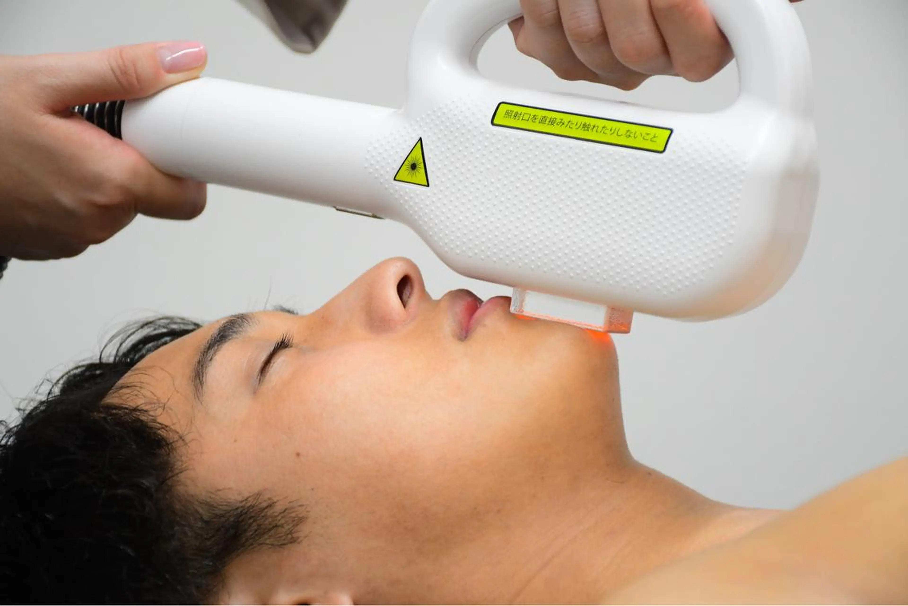 【男性】ヒゲセット[額/ほほ/鼻下/あご/もみあげ]¥19800→¥11000の写真