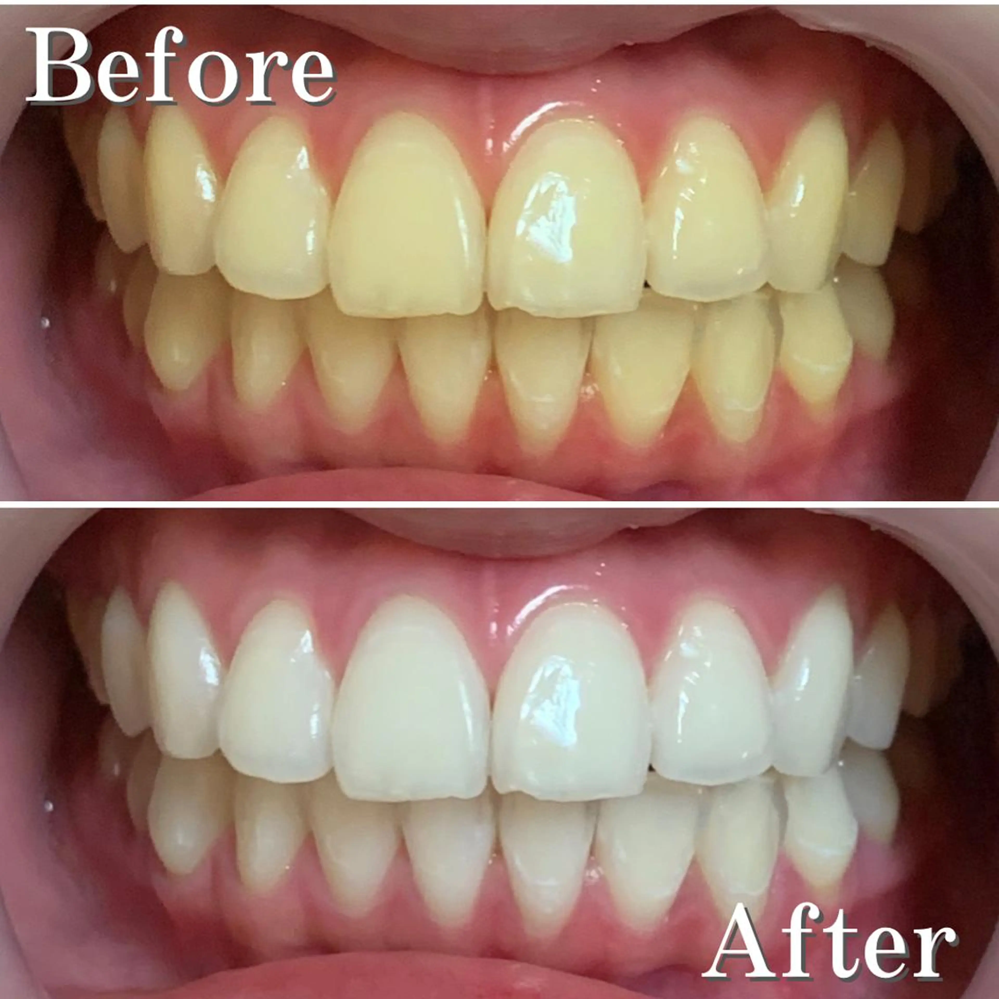 マツエク・マツパ ショート ヘアアレンジ パーマ カラー メンズ ネイル アイブロウ 結婚式・ブライダル メンズアイブロウ 結婚式・ブライダル メンズネイル ブライダルネイル エステ リラク LBSホワイトニング 銀座店💎公式のその他イメージ