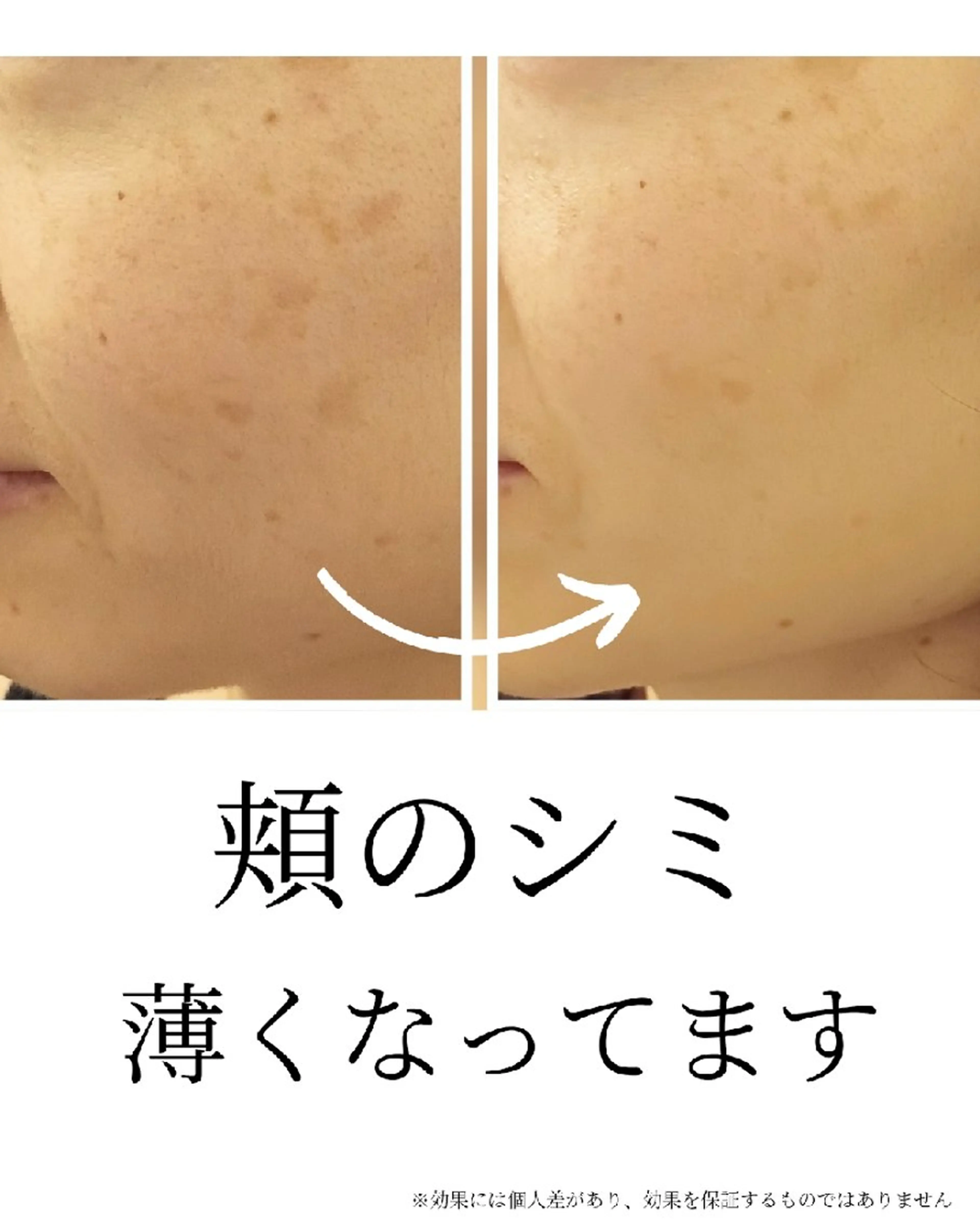 水光肌ピーリング ハーブピーリングのエステ・リラクイメージ