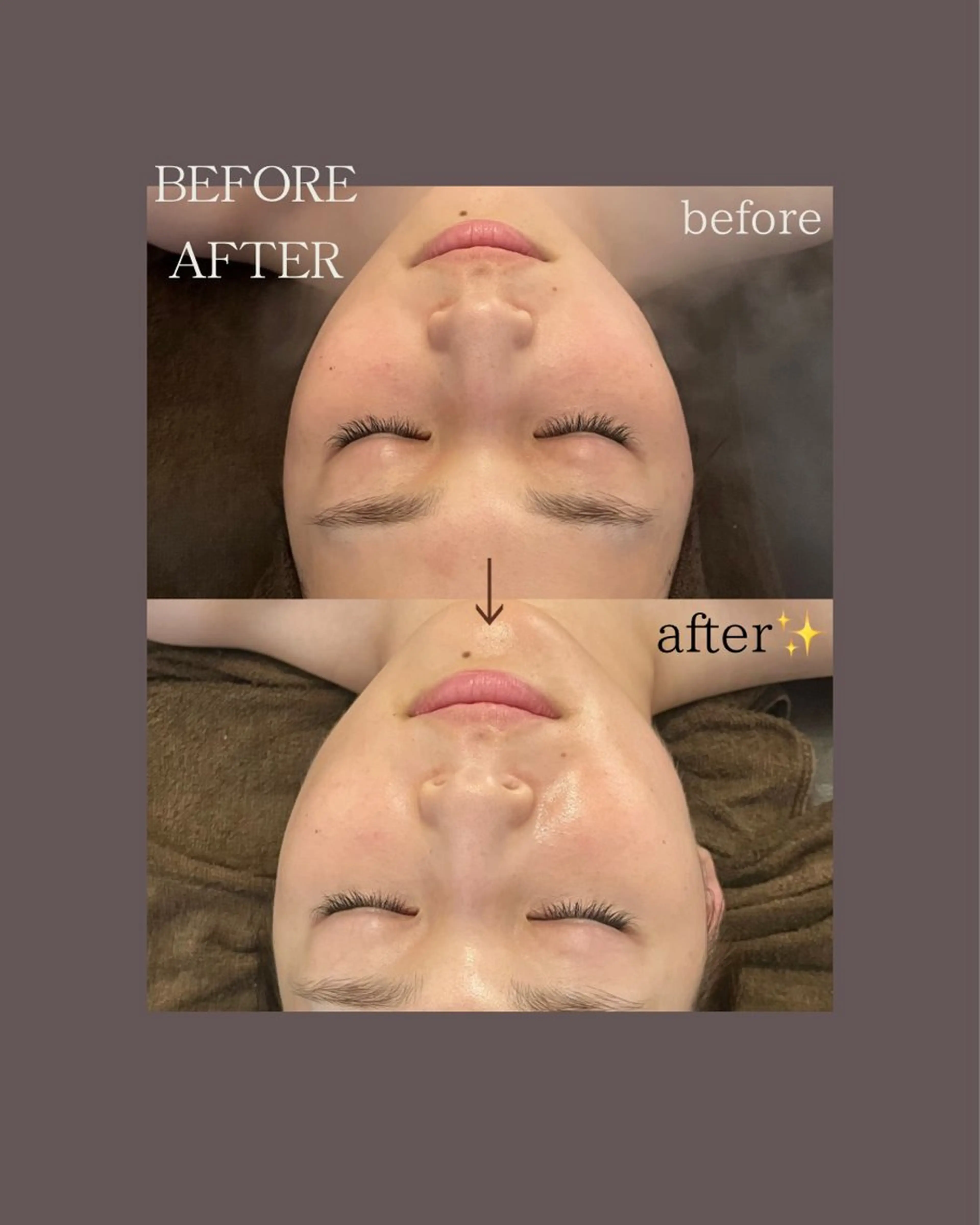 oyam オヤムのエステ・リラクイメージ