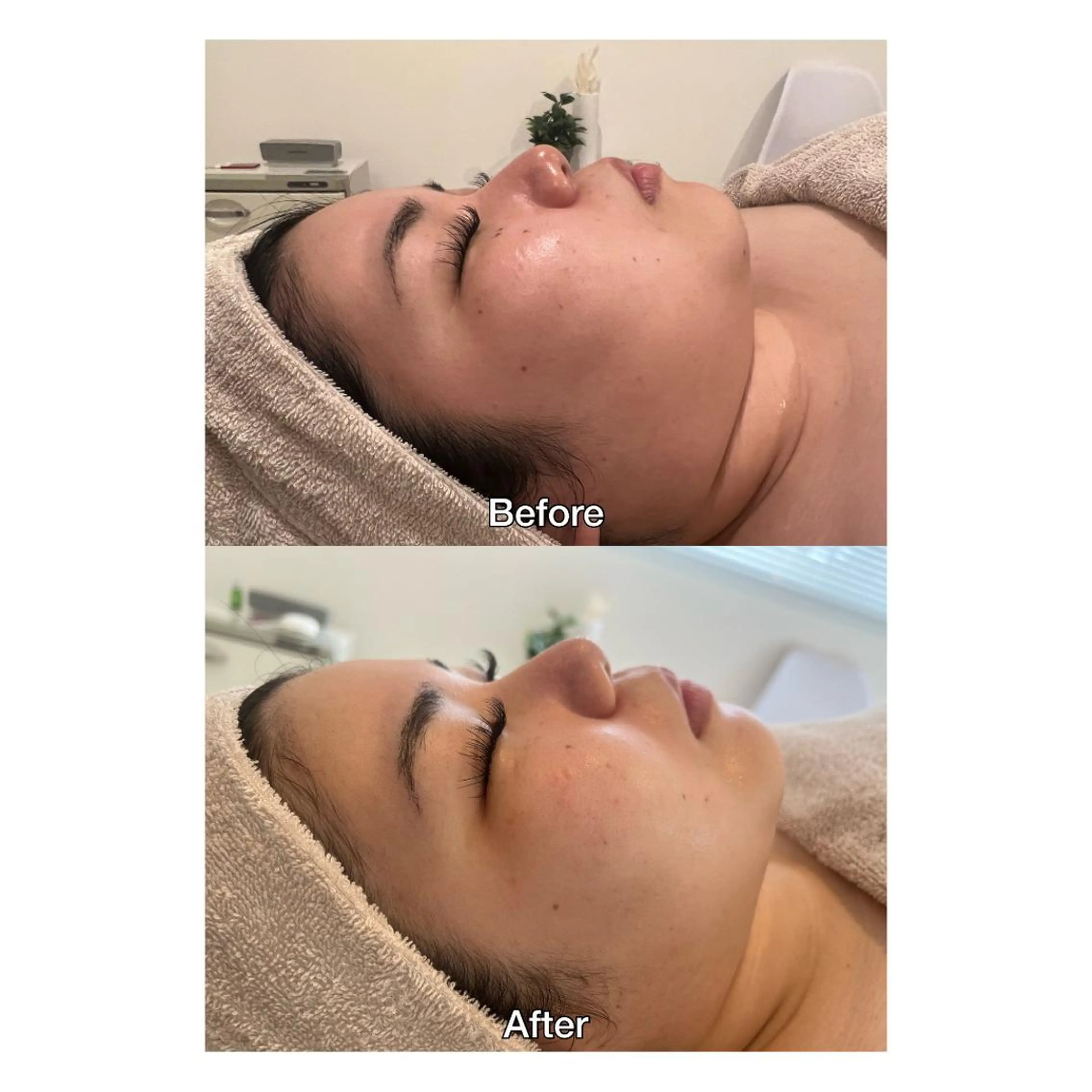 ROOM.S ｜脱毛｜美肌｜ボディのエステ・リラクイメージ