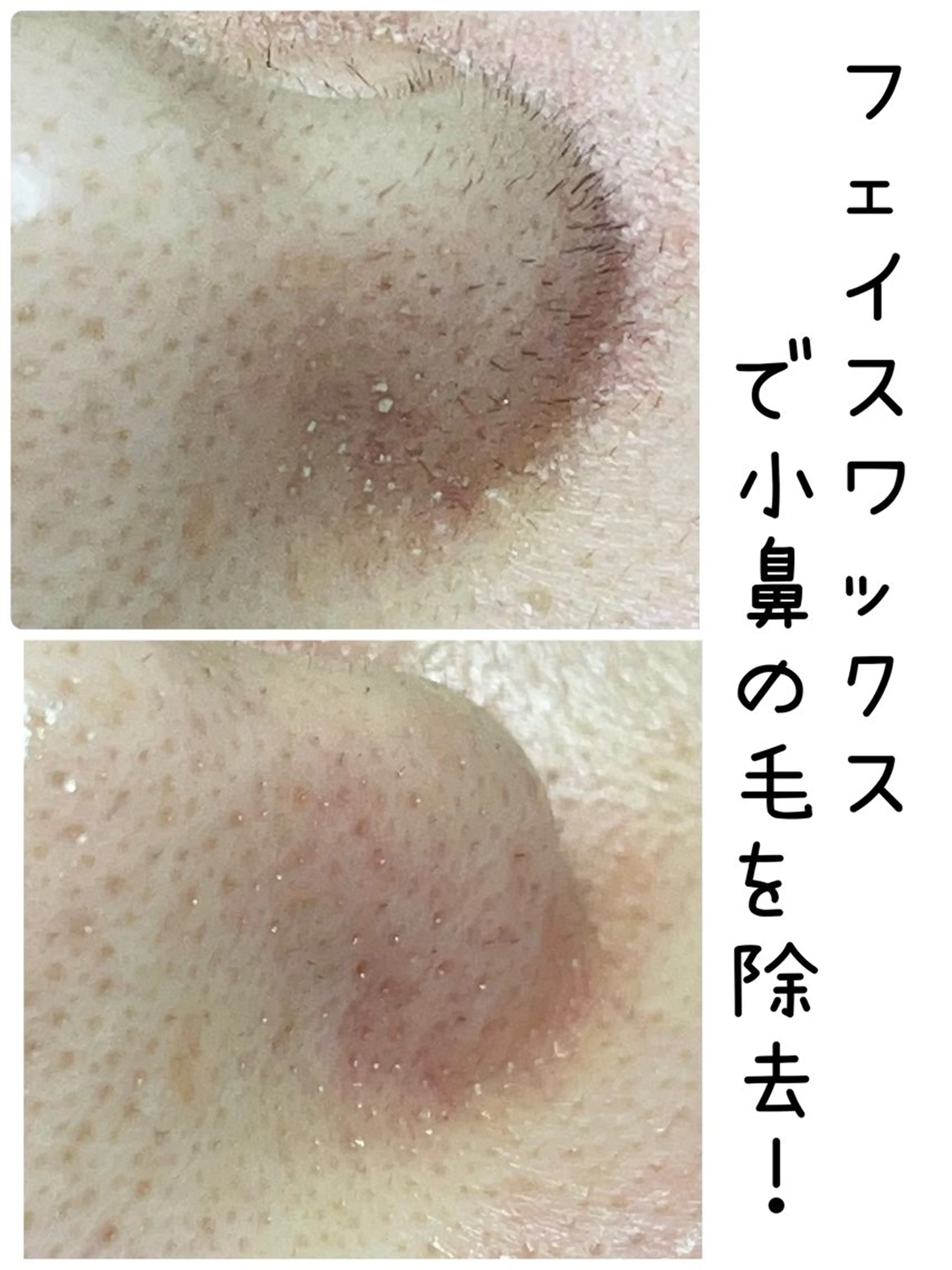 アイブロウ 眉毛ワックス脱毛 private salon OUKA所属・OUKA脱毛 毛穴ケアフェイシャルのエステ・リラクイメージ