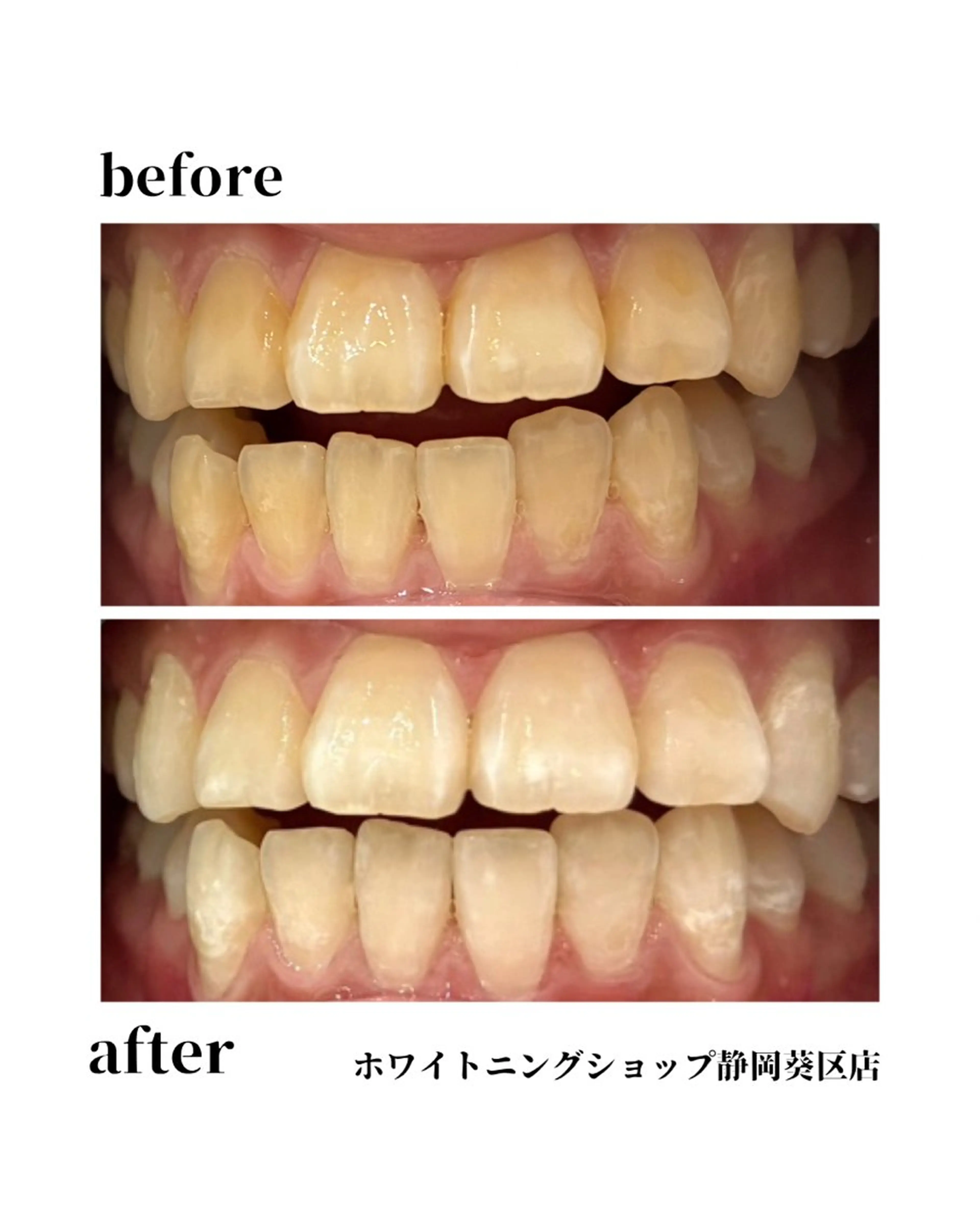 ホワイトニングショップ静岡葵区店所属・ホワイトニング ショップ葵区静岡駅店のその他イメージ