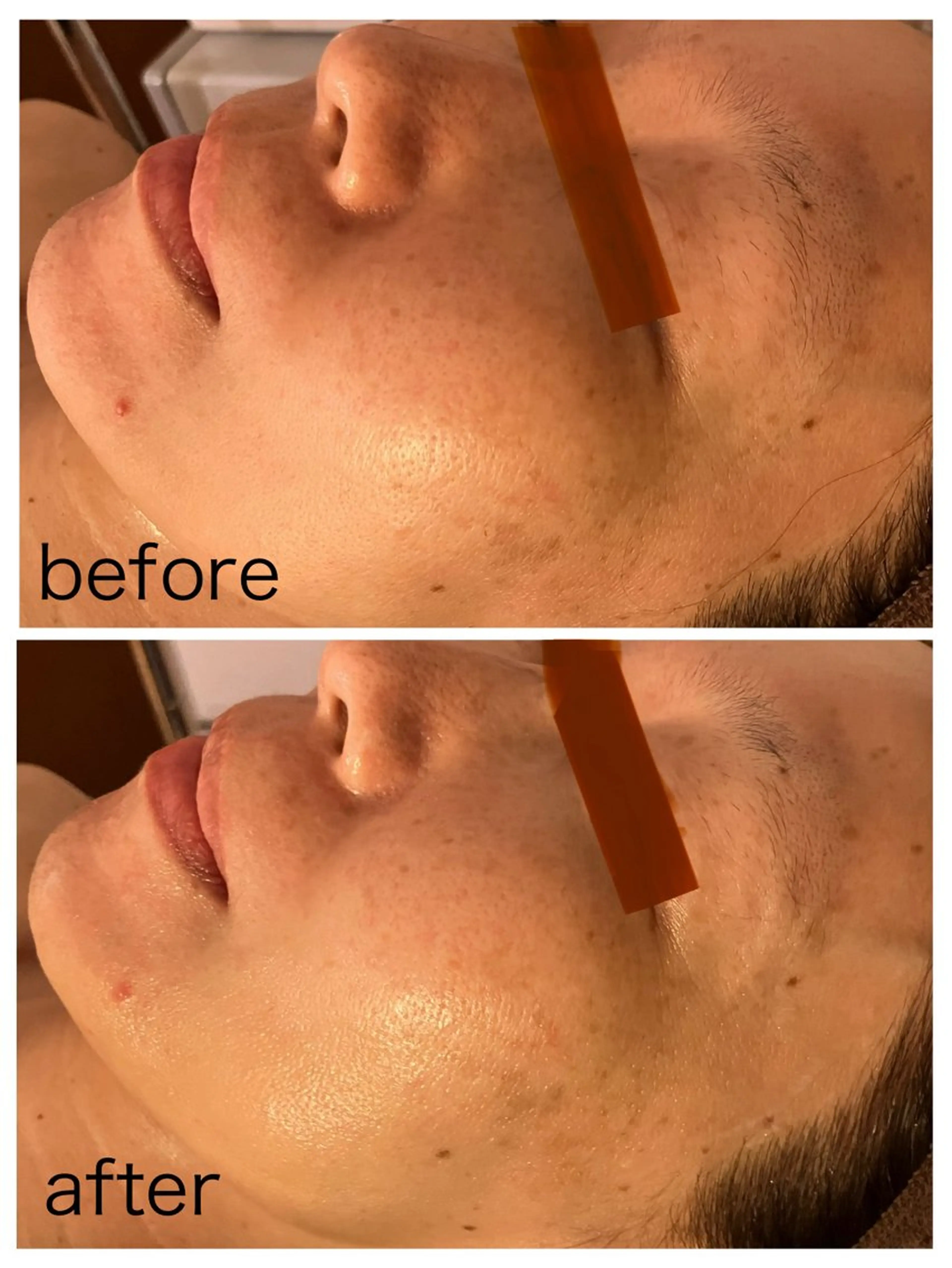 梅本 麿帆のエステ・リラクイメージ