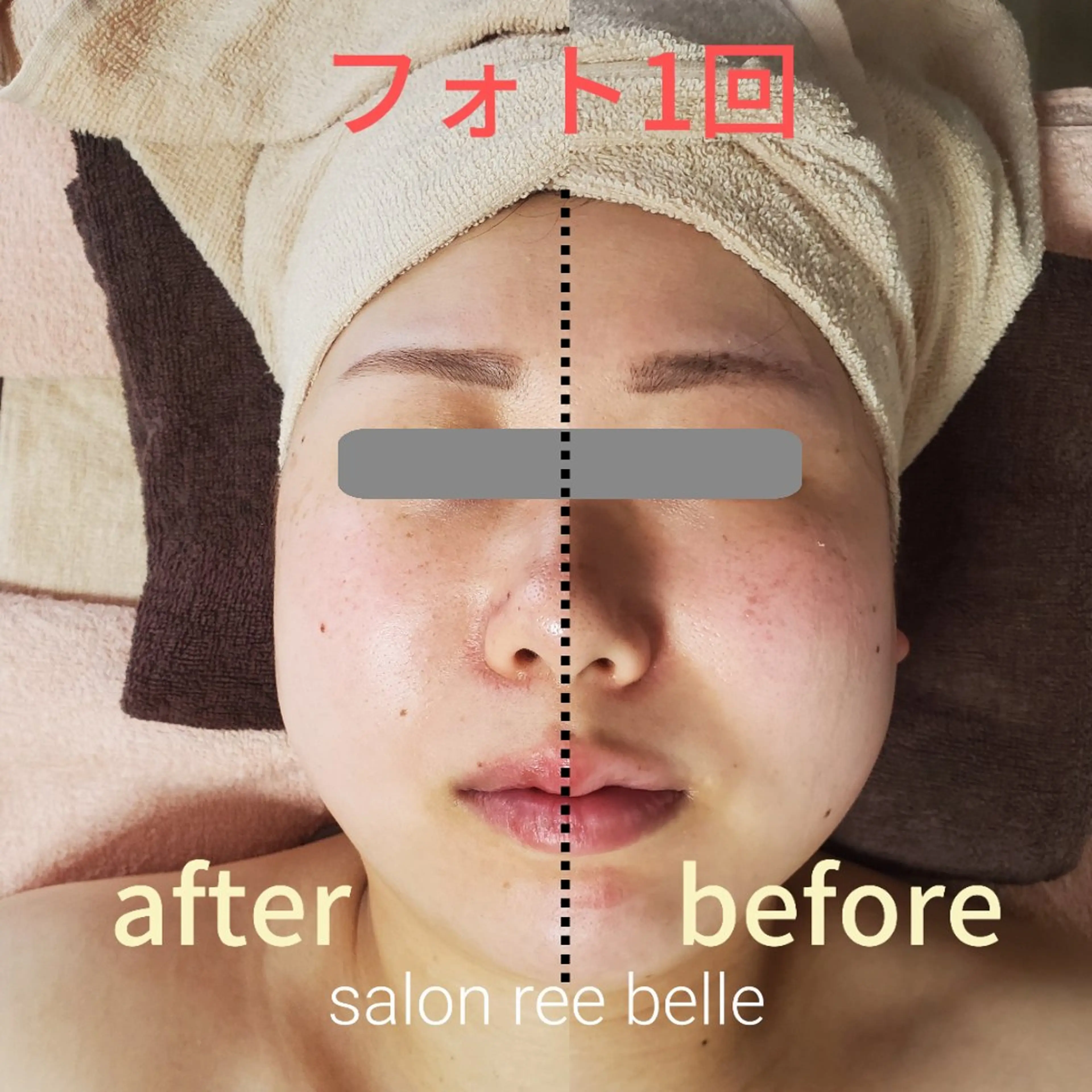 Salon Ree Belle(サロン リベル)所属・サロン リベル YUKAのエステ・リラクイメージ