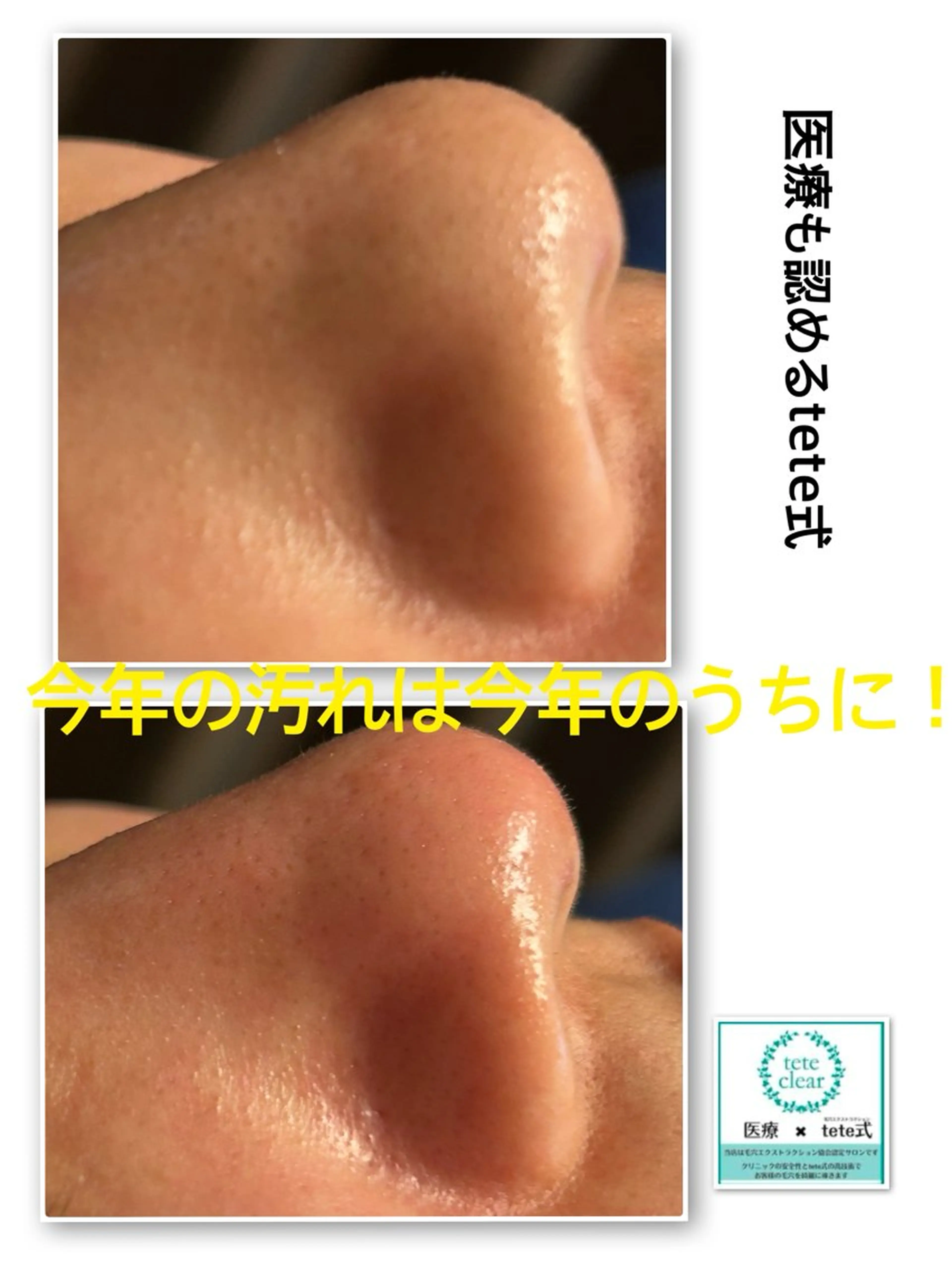 エステ リフュージュ所属・リフュージュ隠れ家 八王子の眉毛・アイブロウイメージ