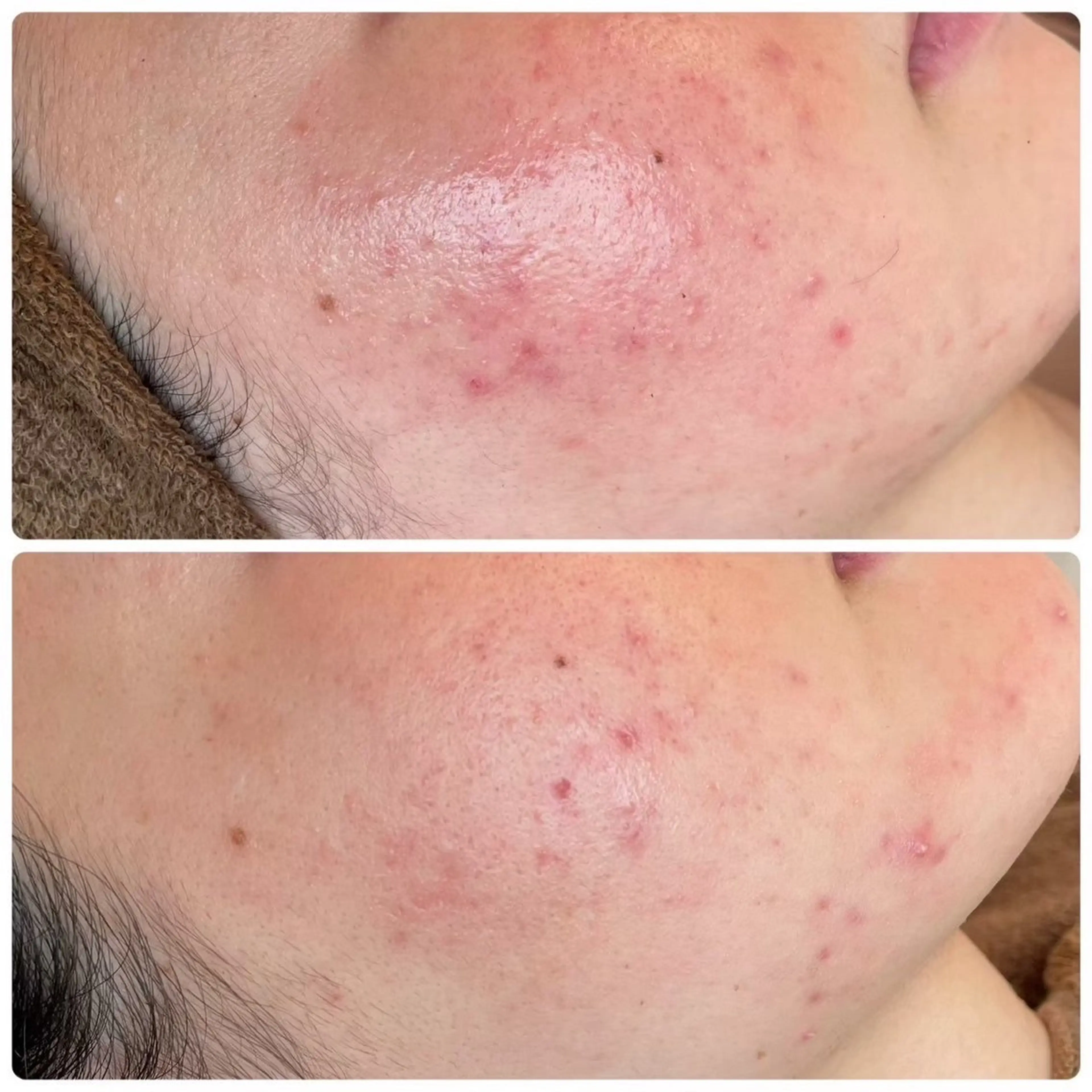 エステ リラク 肌質改善エステ chiffonのエステ・リラクイメージ